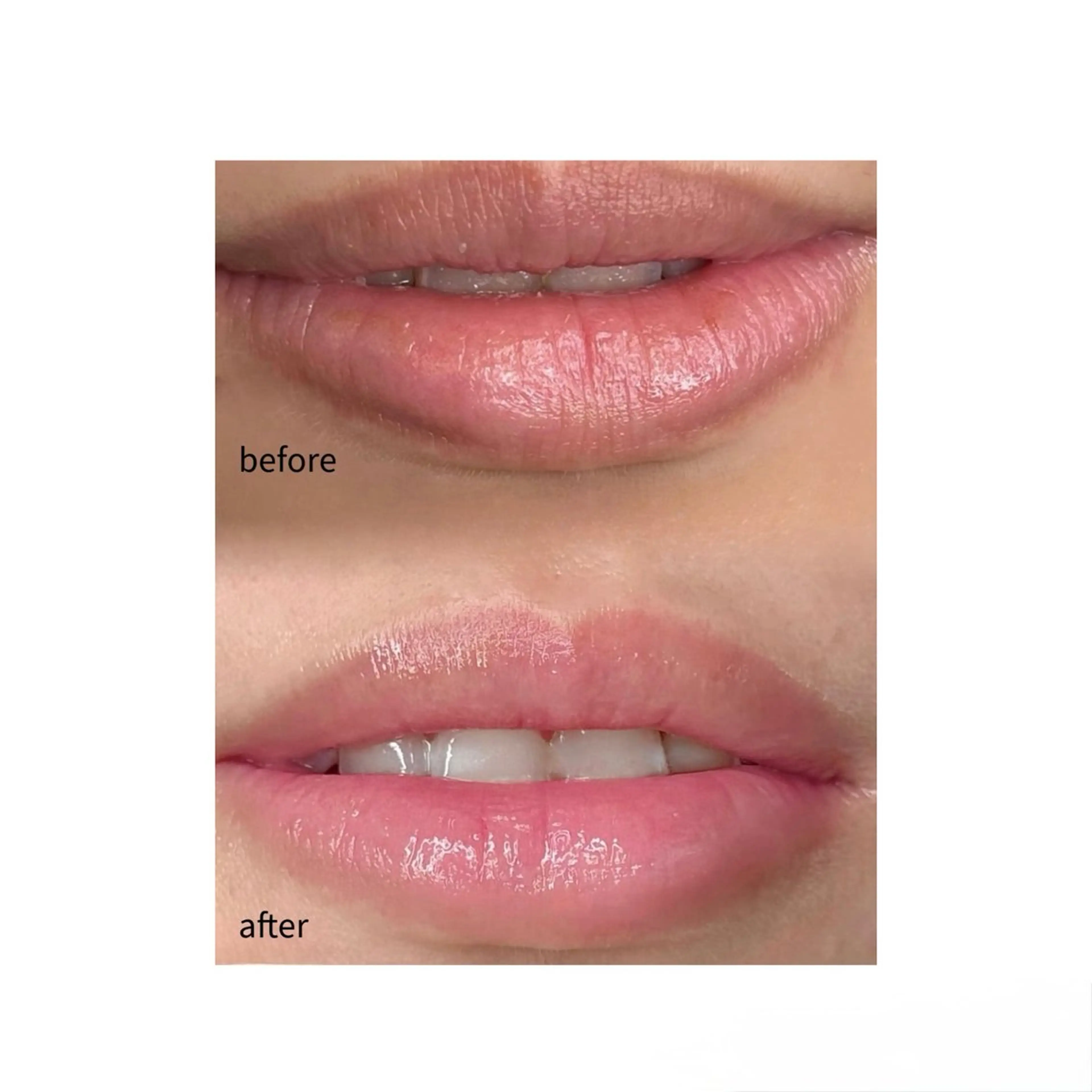 レティティア【Laetitia】所属・レティティア秋葉原店 Yoshizawaのエステ・リラクイメージ