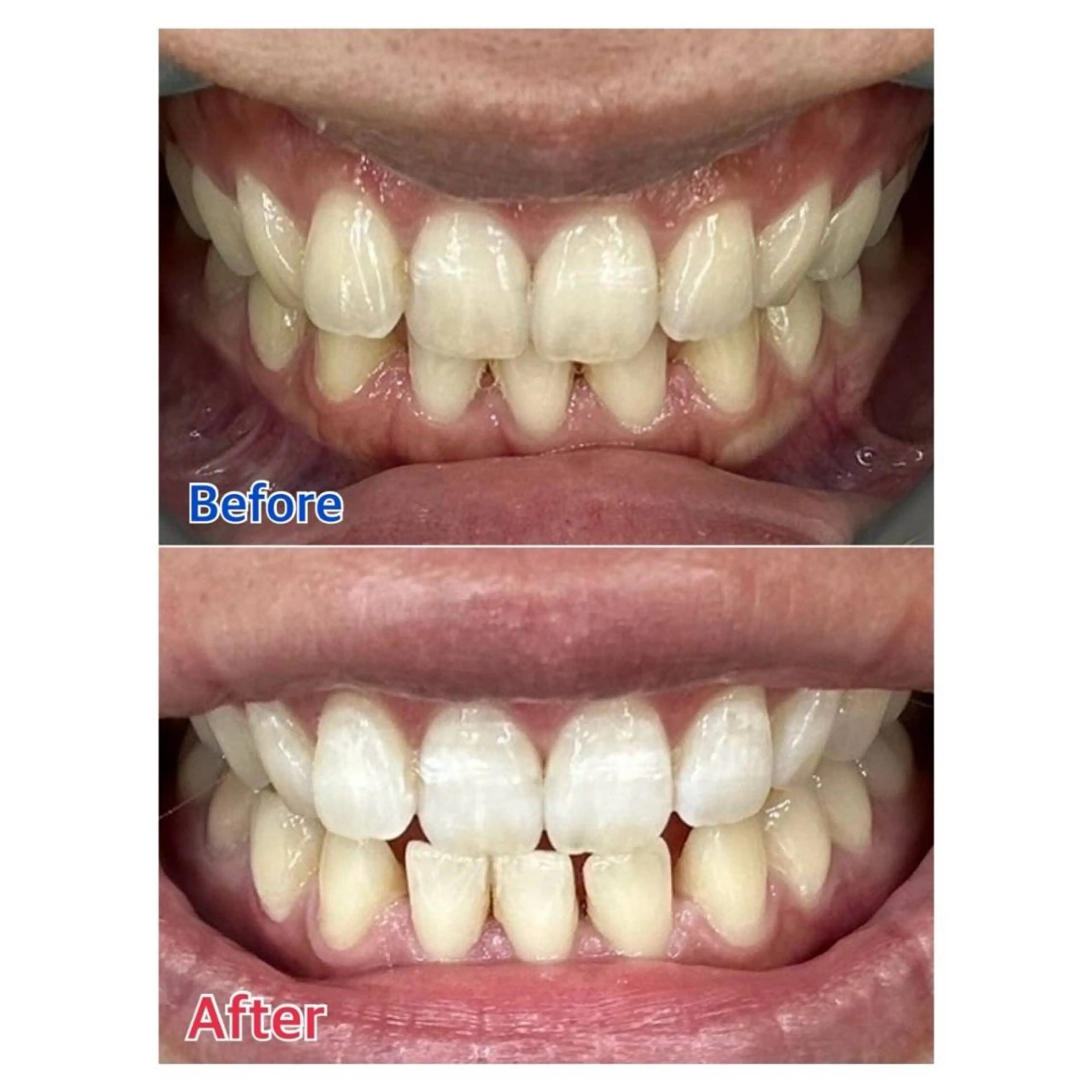 Melty 輝のその他イメージ