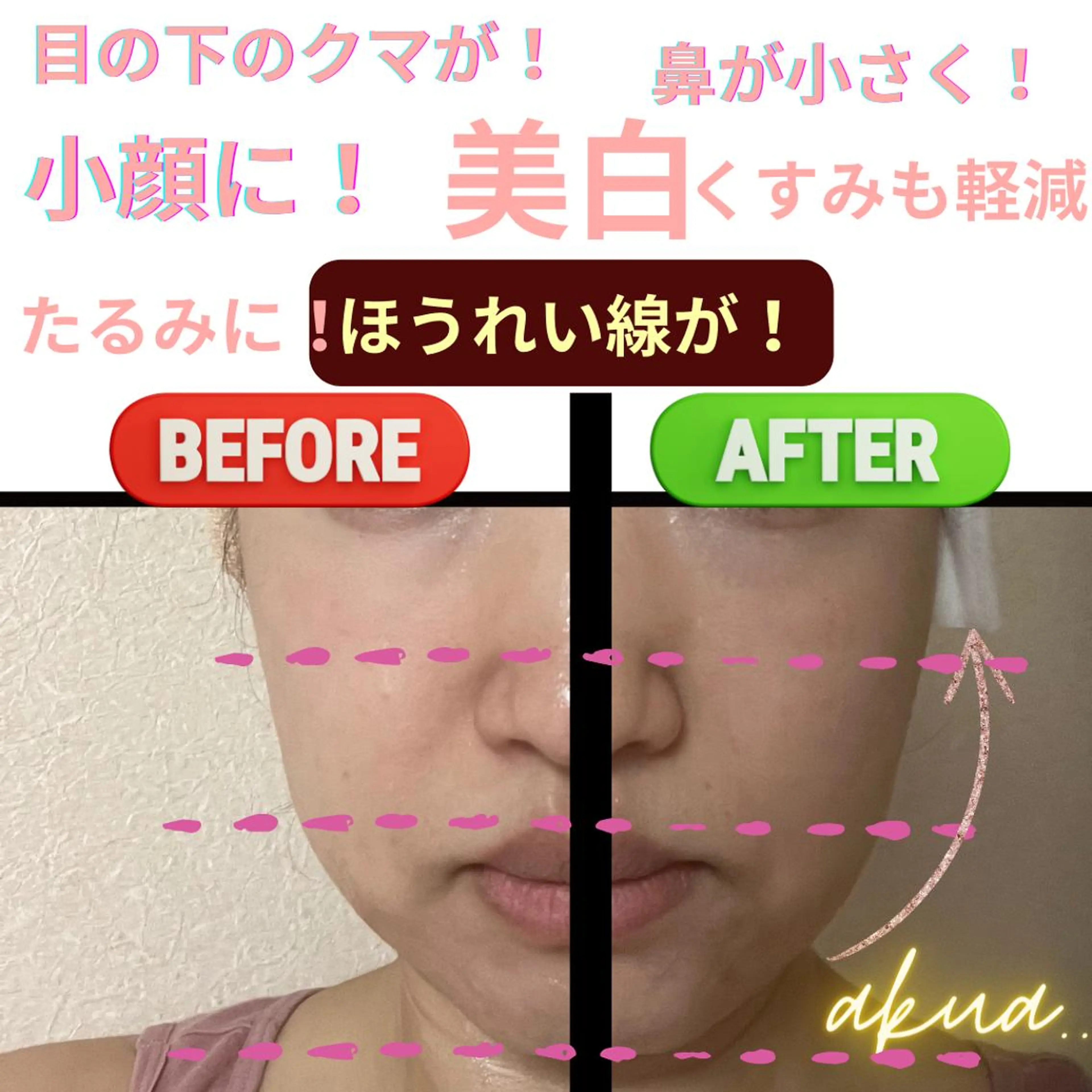 LUMINAルミナ 【肌管理サロン】のその他イメージ