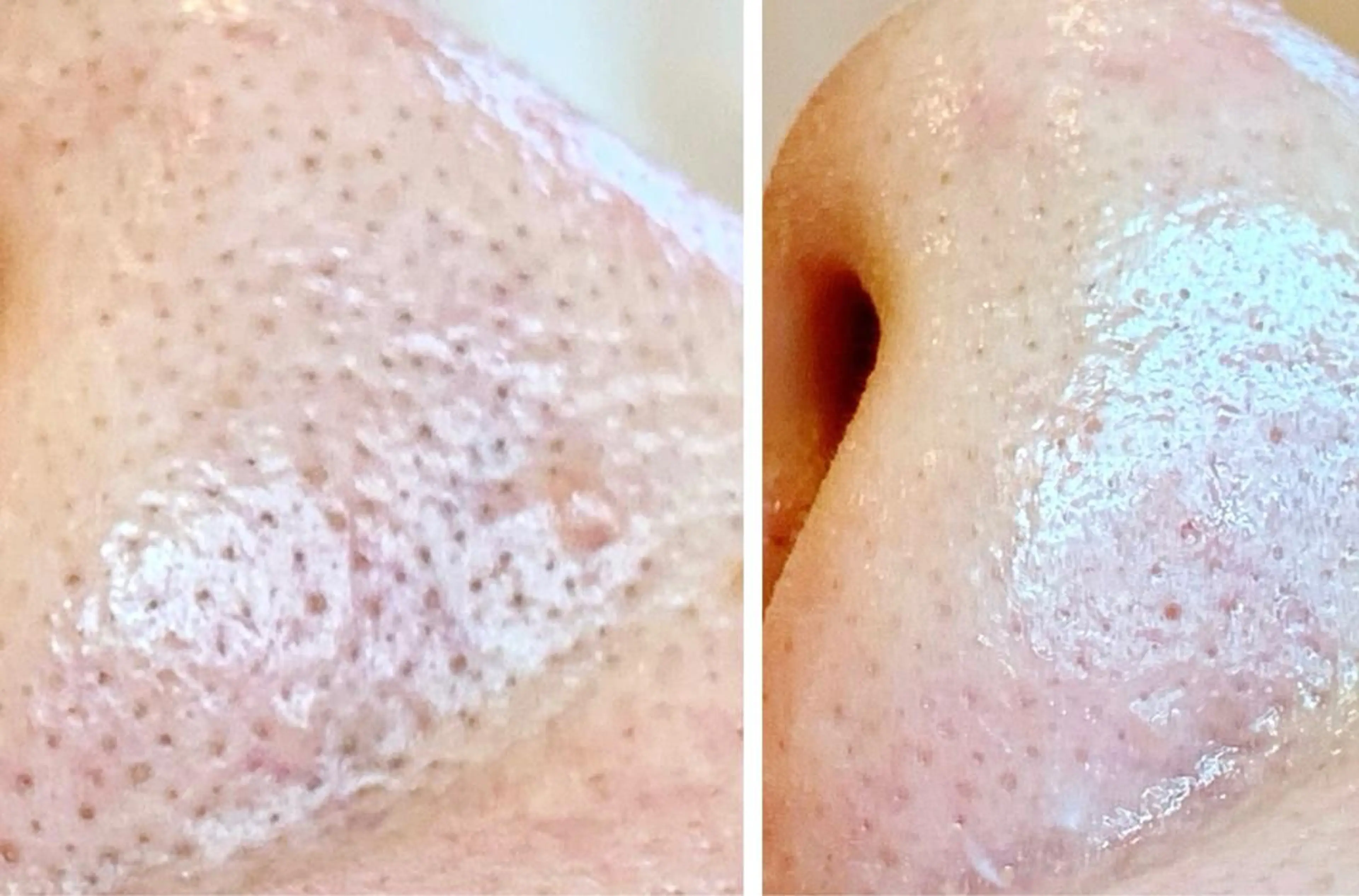 朝重い人専用 肩甲骨調整のエステ・リラクイメージ