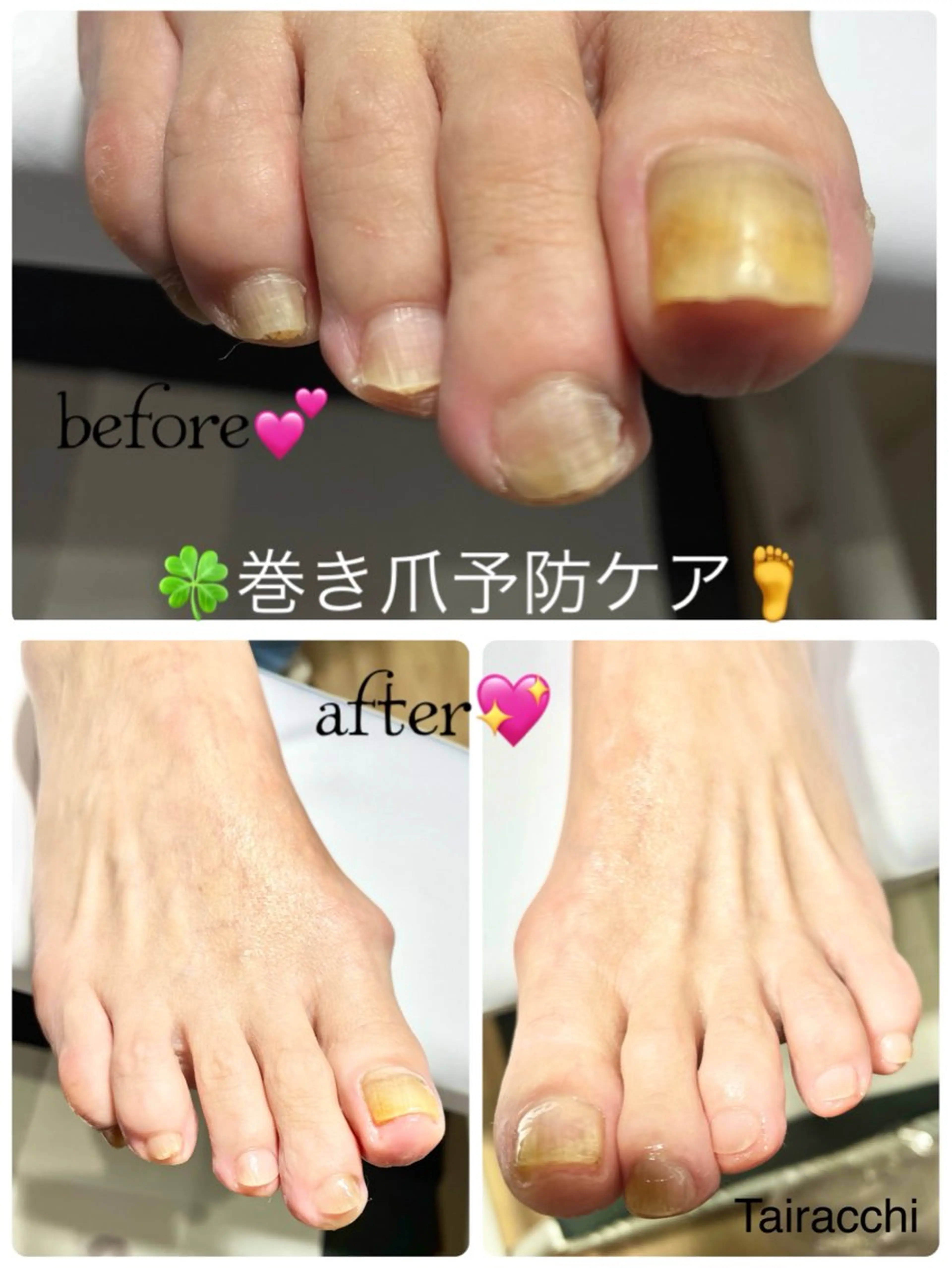 ネイル フットネイル フットネイル Tairacchi タイラッチのネイルデザイン