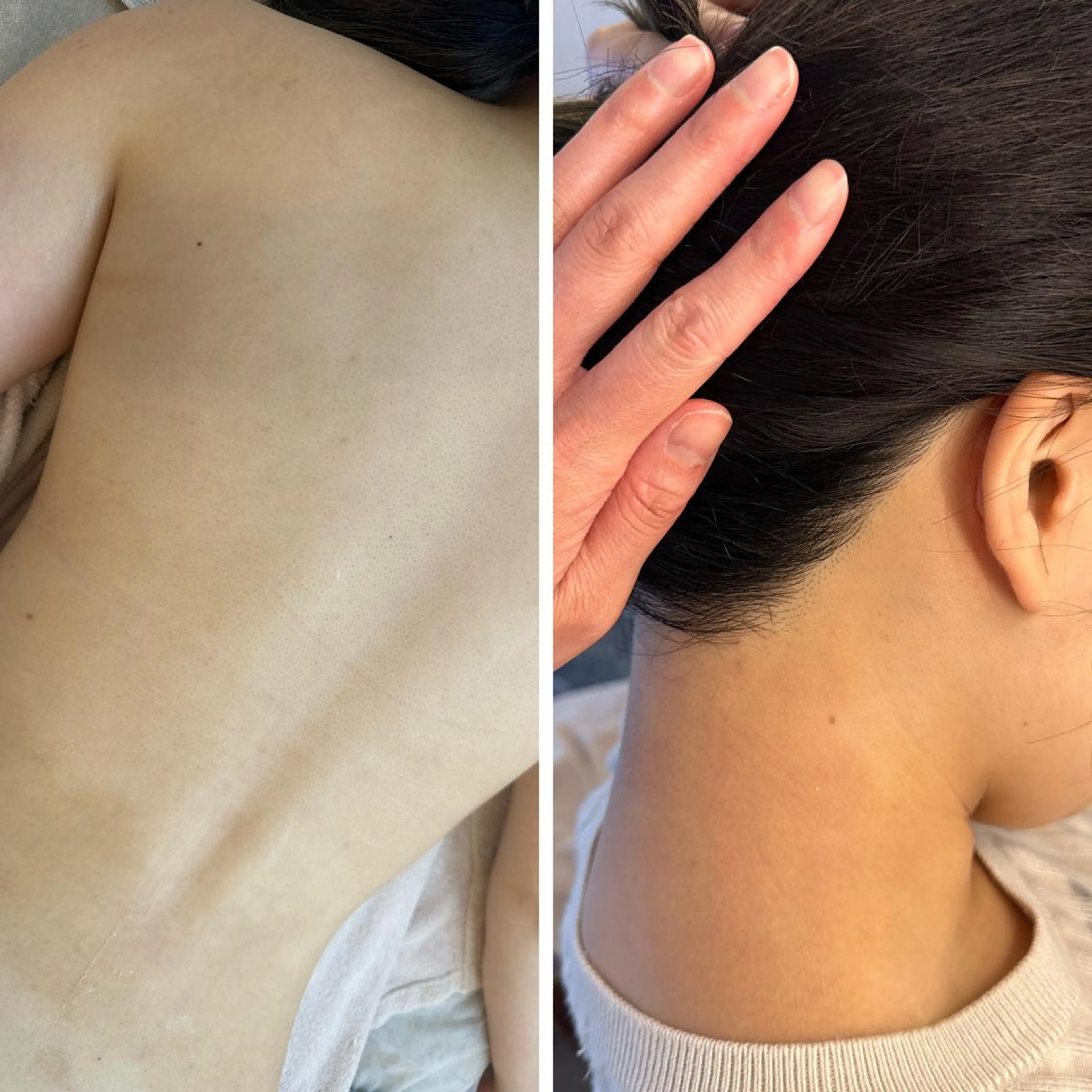 うなじ脱毛/美肌脱毛 LABELのエステ・リラクイメージ