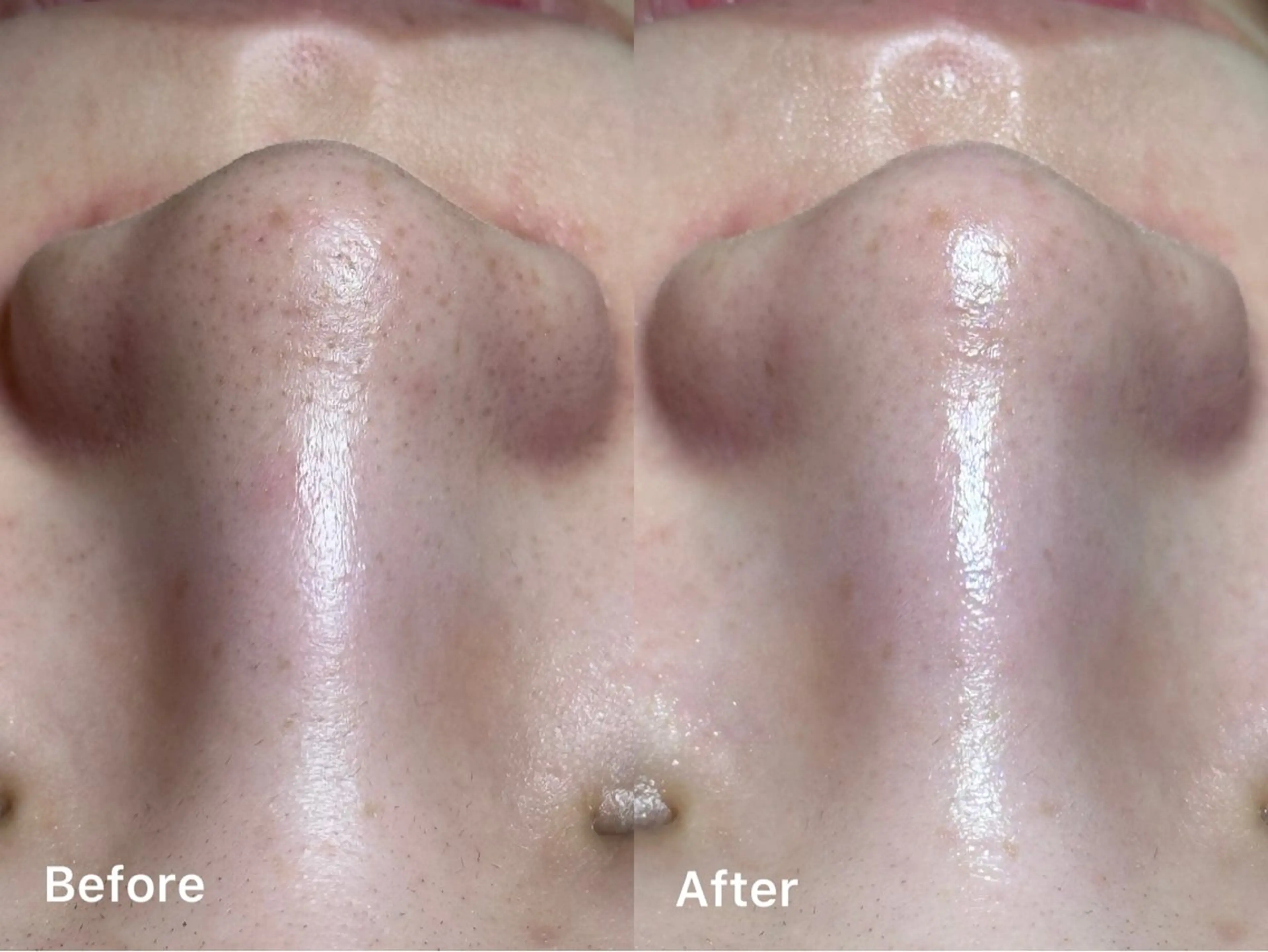 エステ MilleTendresses所属・本町オールハンド リラク/女性専用💐のエステ・リラクイメージ