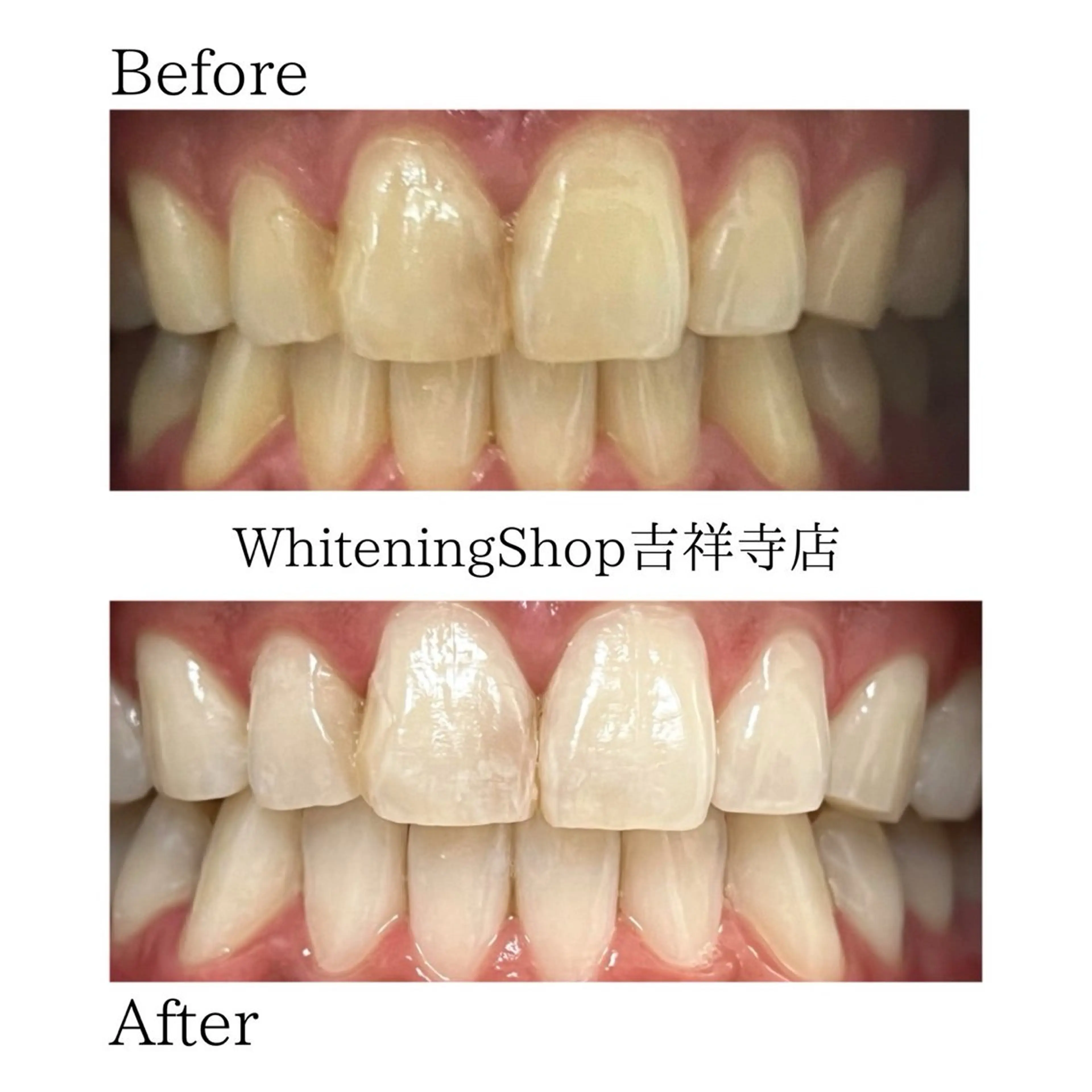 エステ リラク ホワイトニング ショップ吉祥寺店のエステ・リラクイメージ