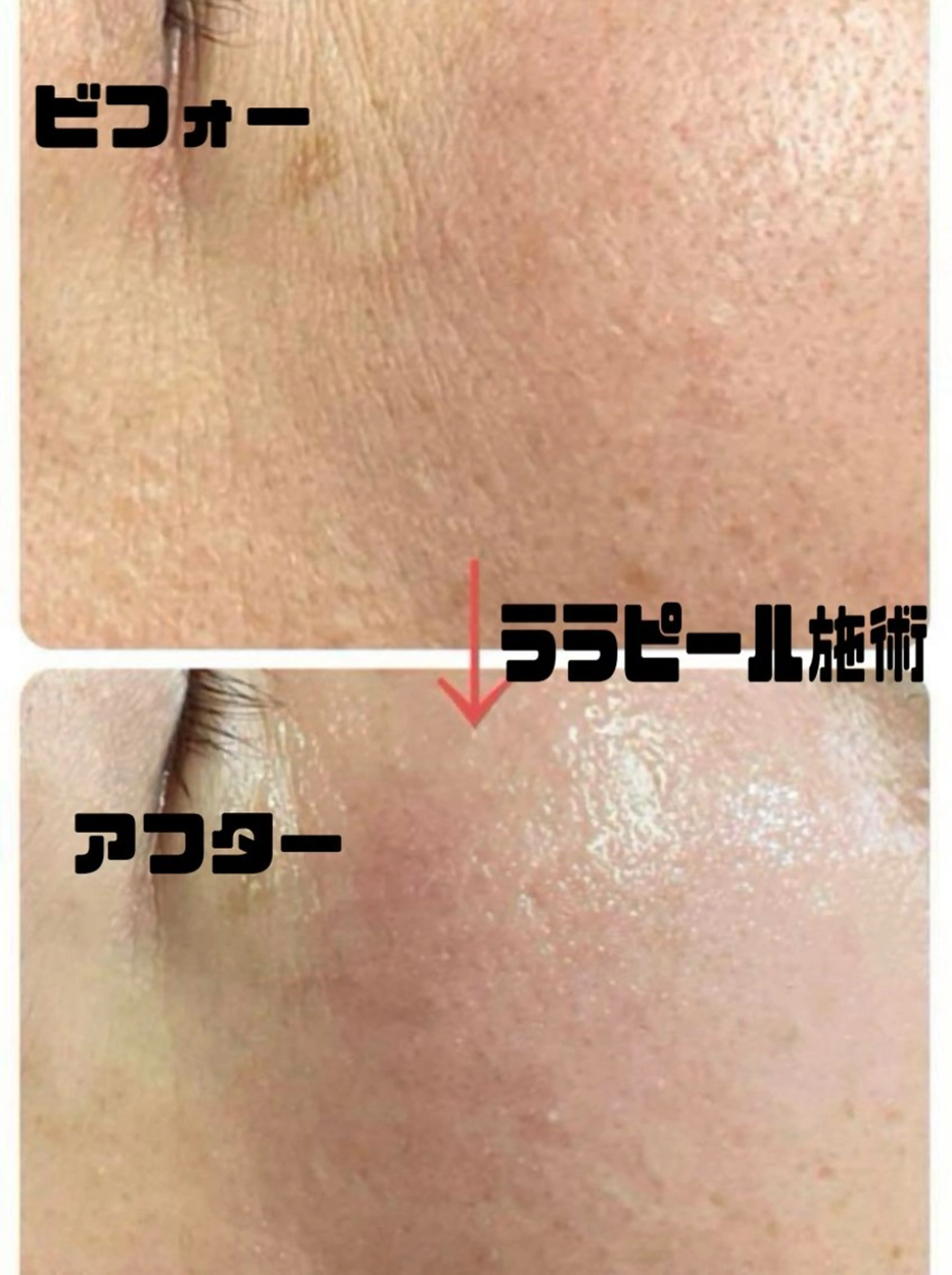 エステ 山崎 陽子のエステ・リラクイメージ