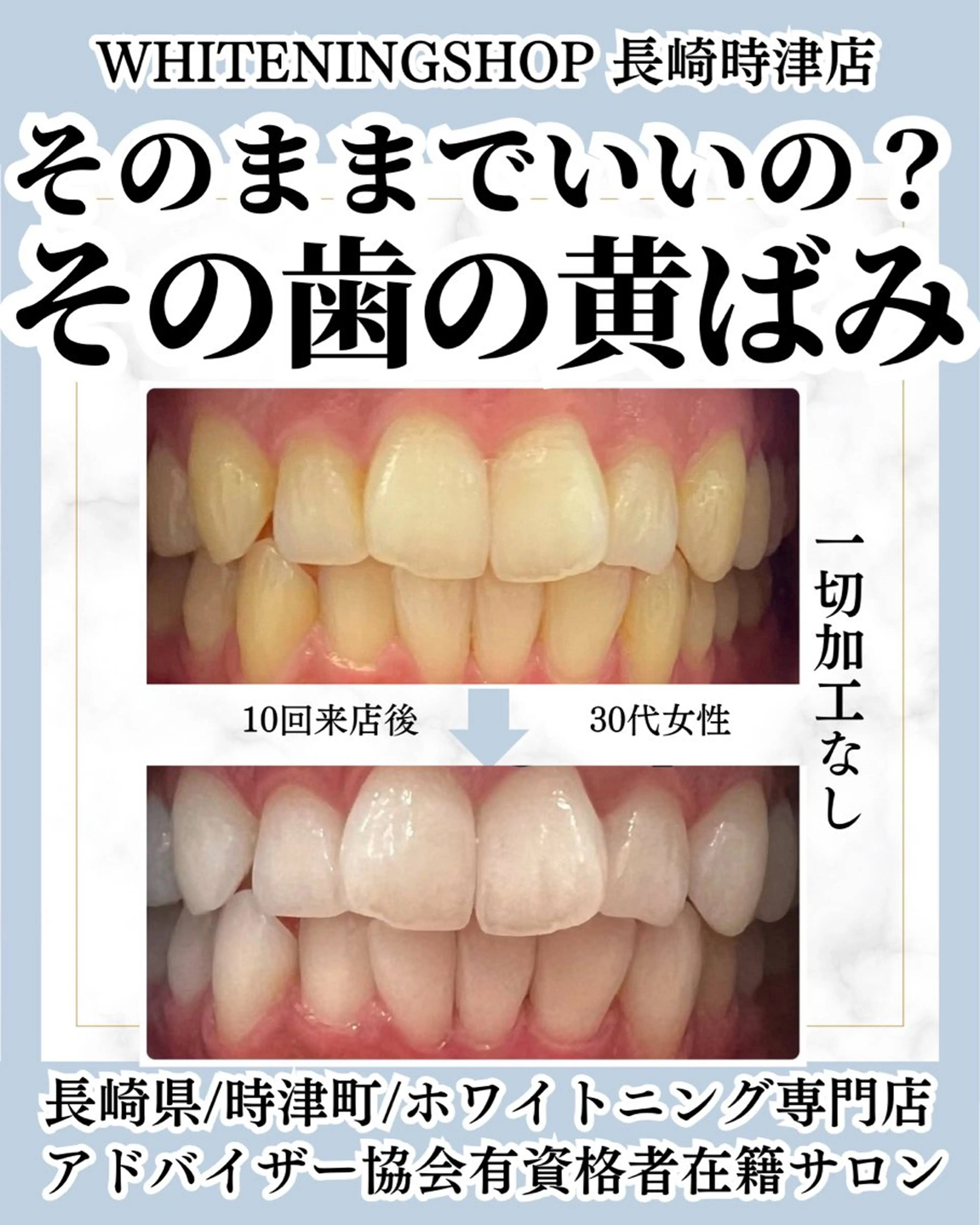 その他 ホワイトニングショップ時津店所属・ホワイトニング ショップ長崎時津店のその他イメージ