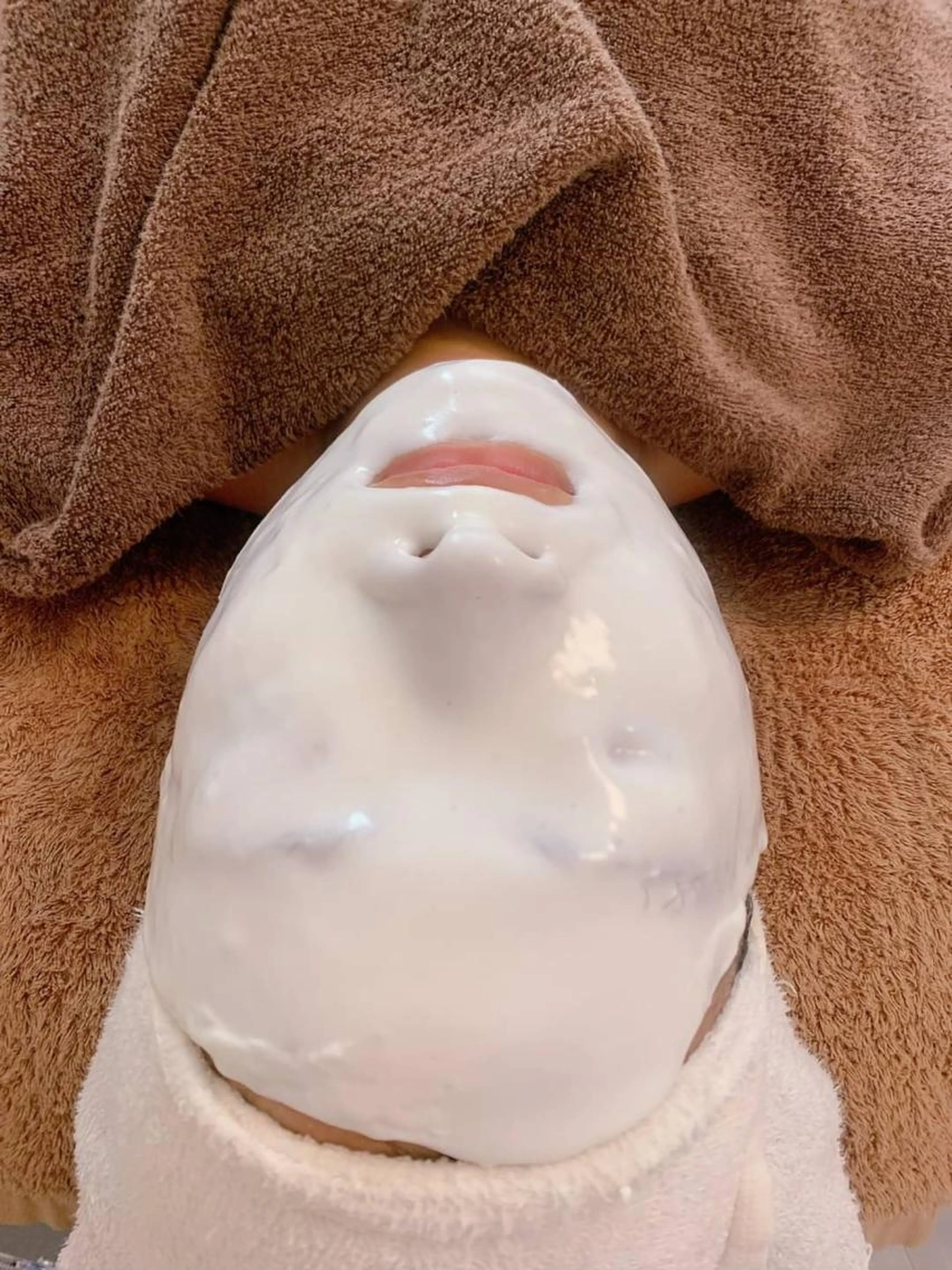 美白だけじゃない保湿もしっかり❄️スタンダードコース＋ホワイトニングパック　8800円→4400円の写真