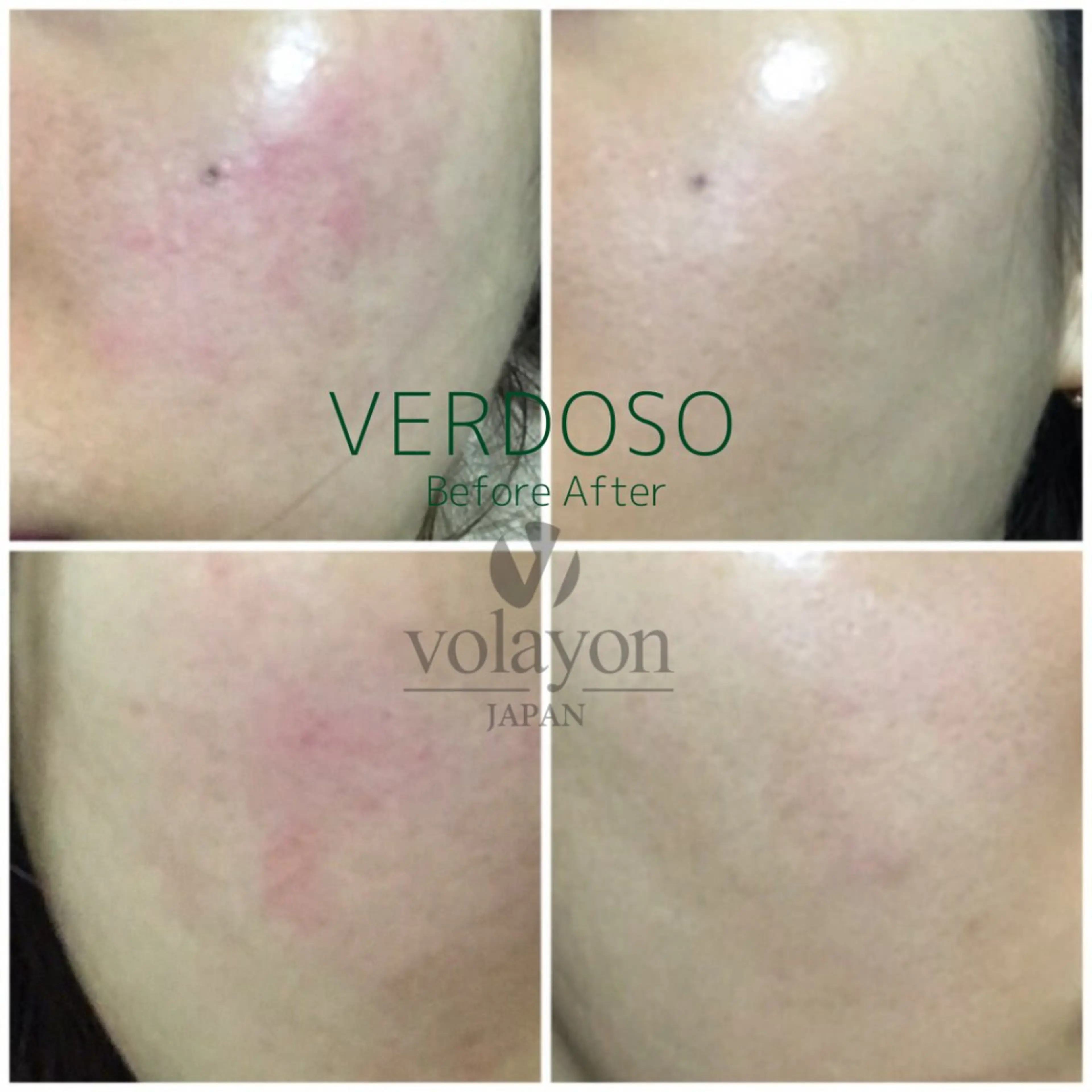 エステ リラク 【韓国肌管理・脱毛】 クレセントのその他イメージ