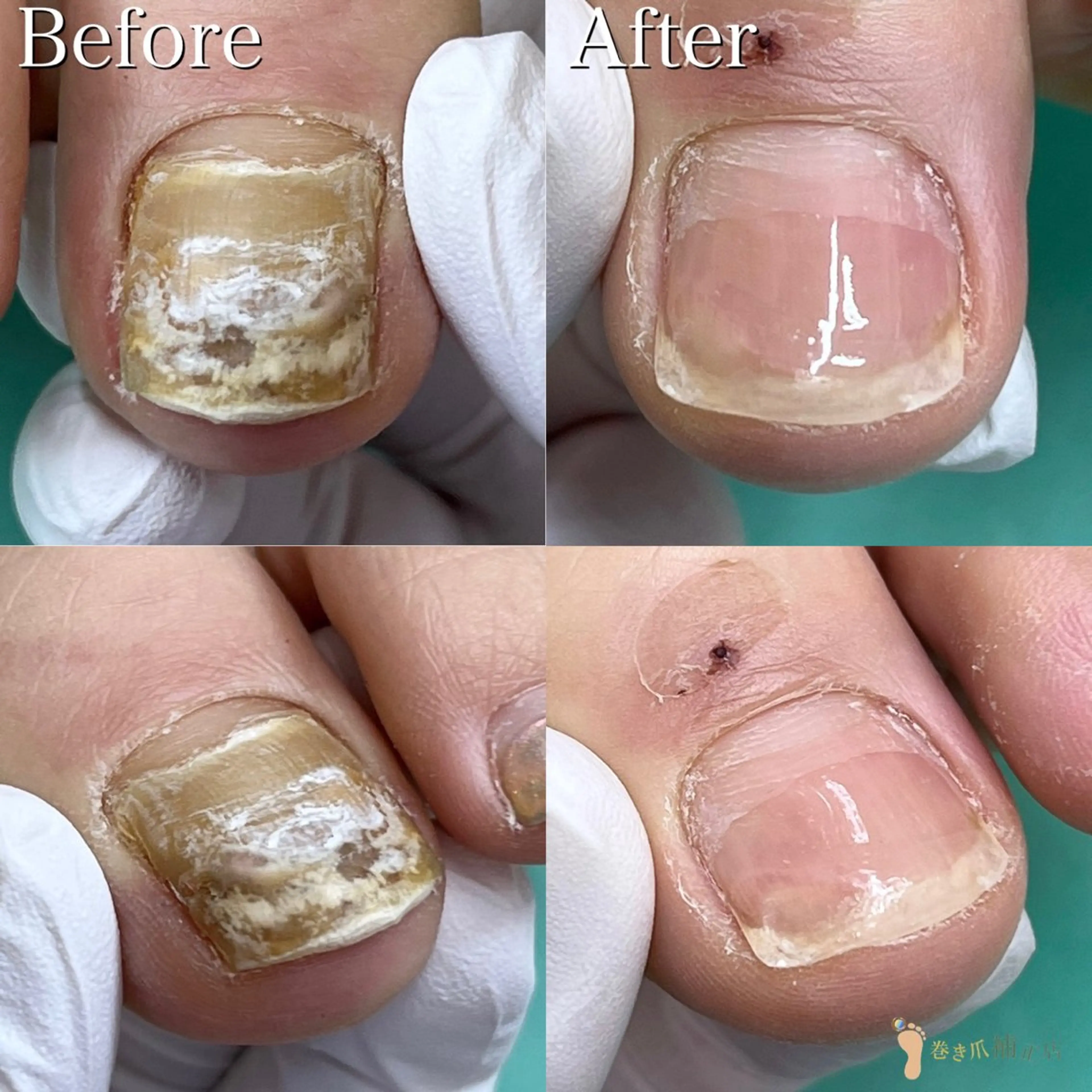 ネイル 東京巻き爪アカデミー所属・東京巻き爪 アカデミーのエステ・リラクイメージ