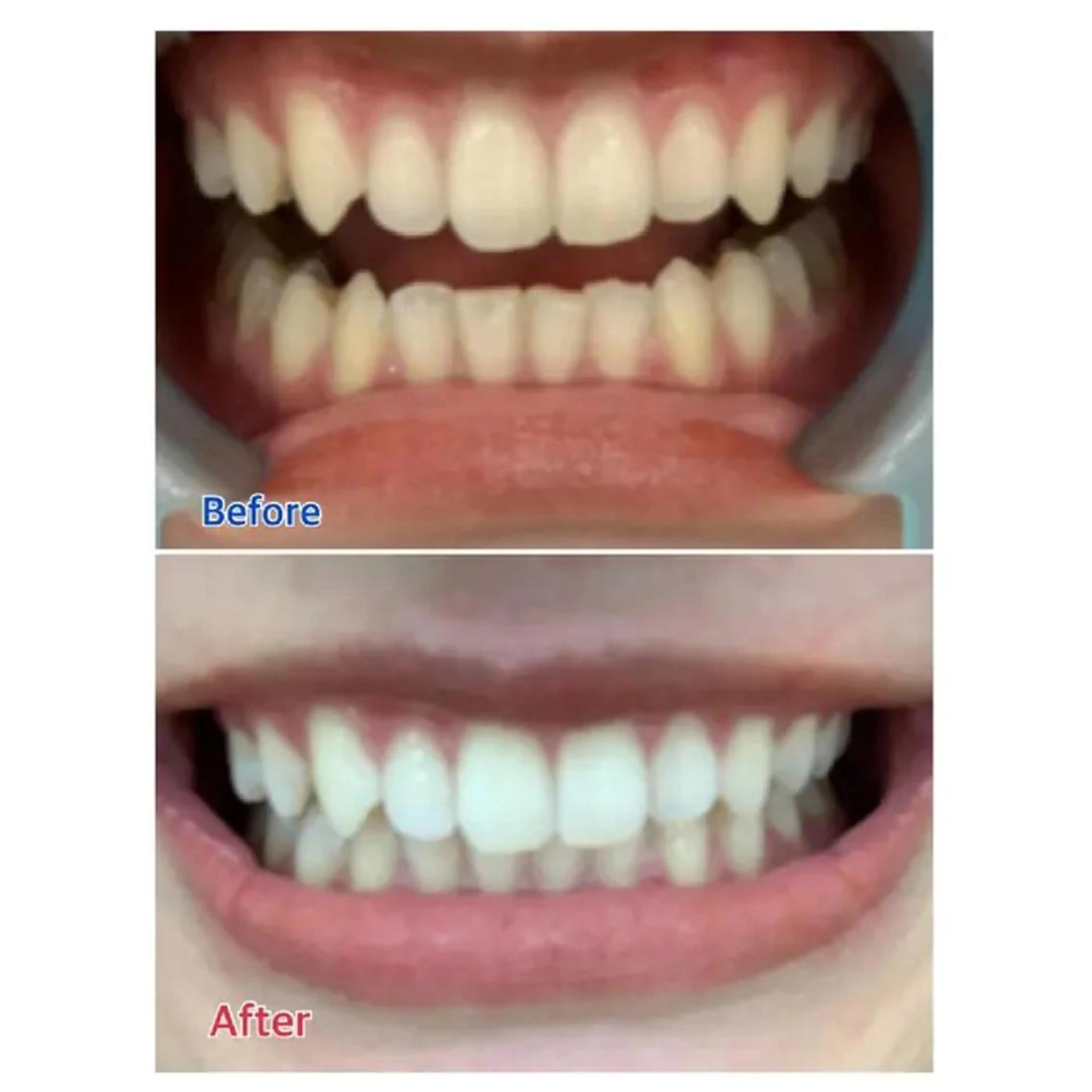 M渋谷 ホワイトニングのその他イメージ