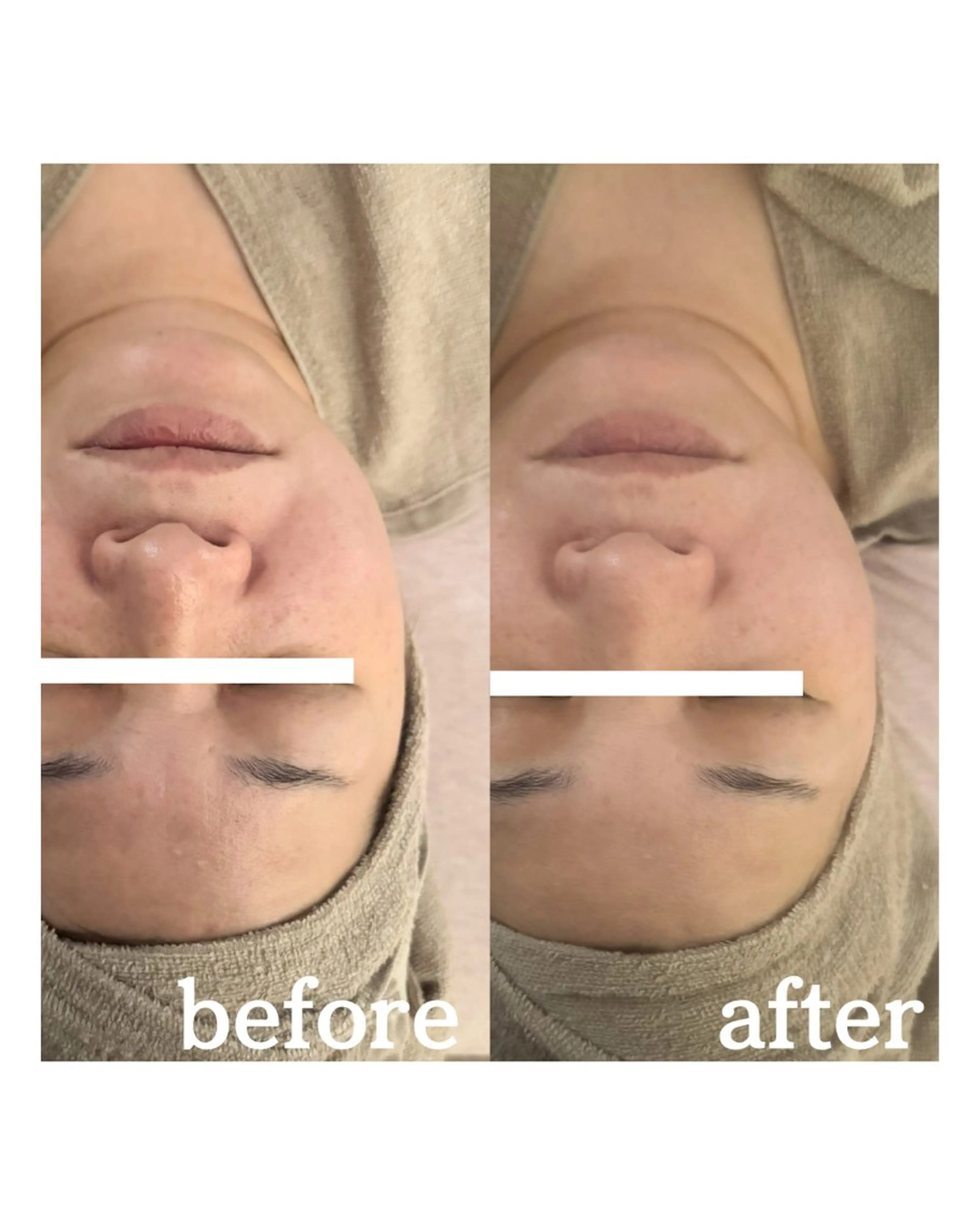 Mignon Luluのエステ・リラクイメージ