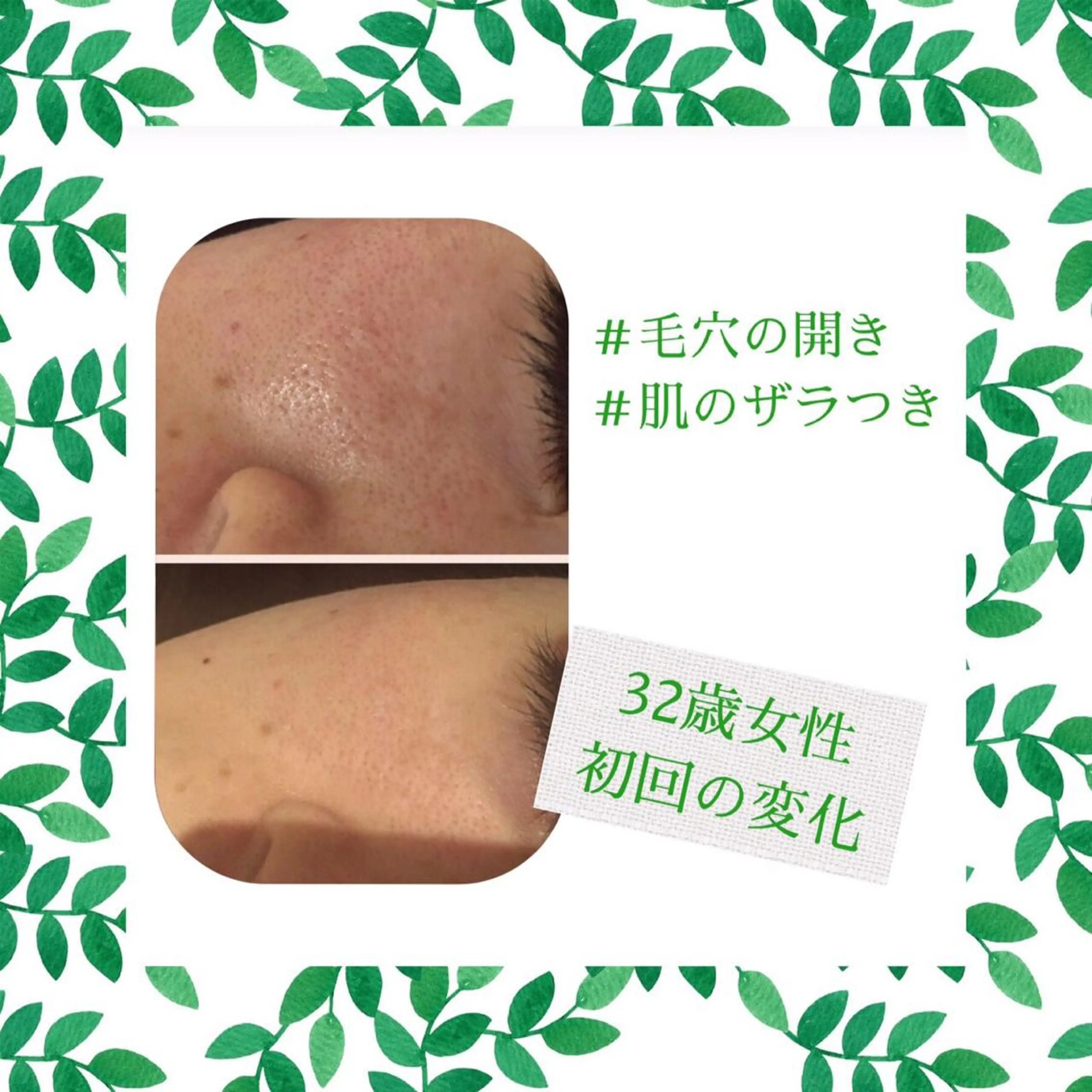 ミディアム カラー パーマ ヘアアレンジ メンズ キッズ ネイル マツエク・マツパ エステ リラク ニキビ・肌質改善専門 ♡人生が変わるサロンのエステ・リラクイメージ