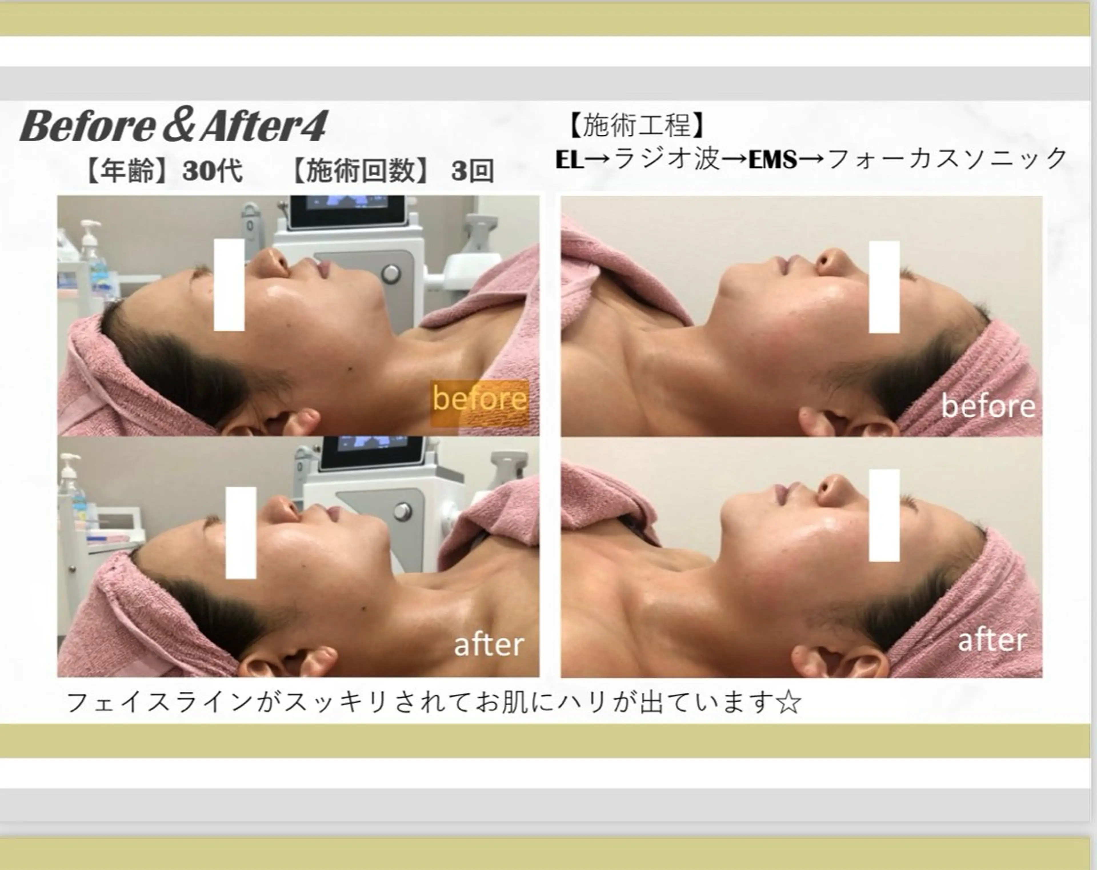 エステ nico sideのエステ・リラクイメージ