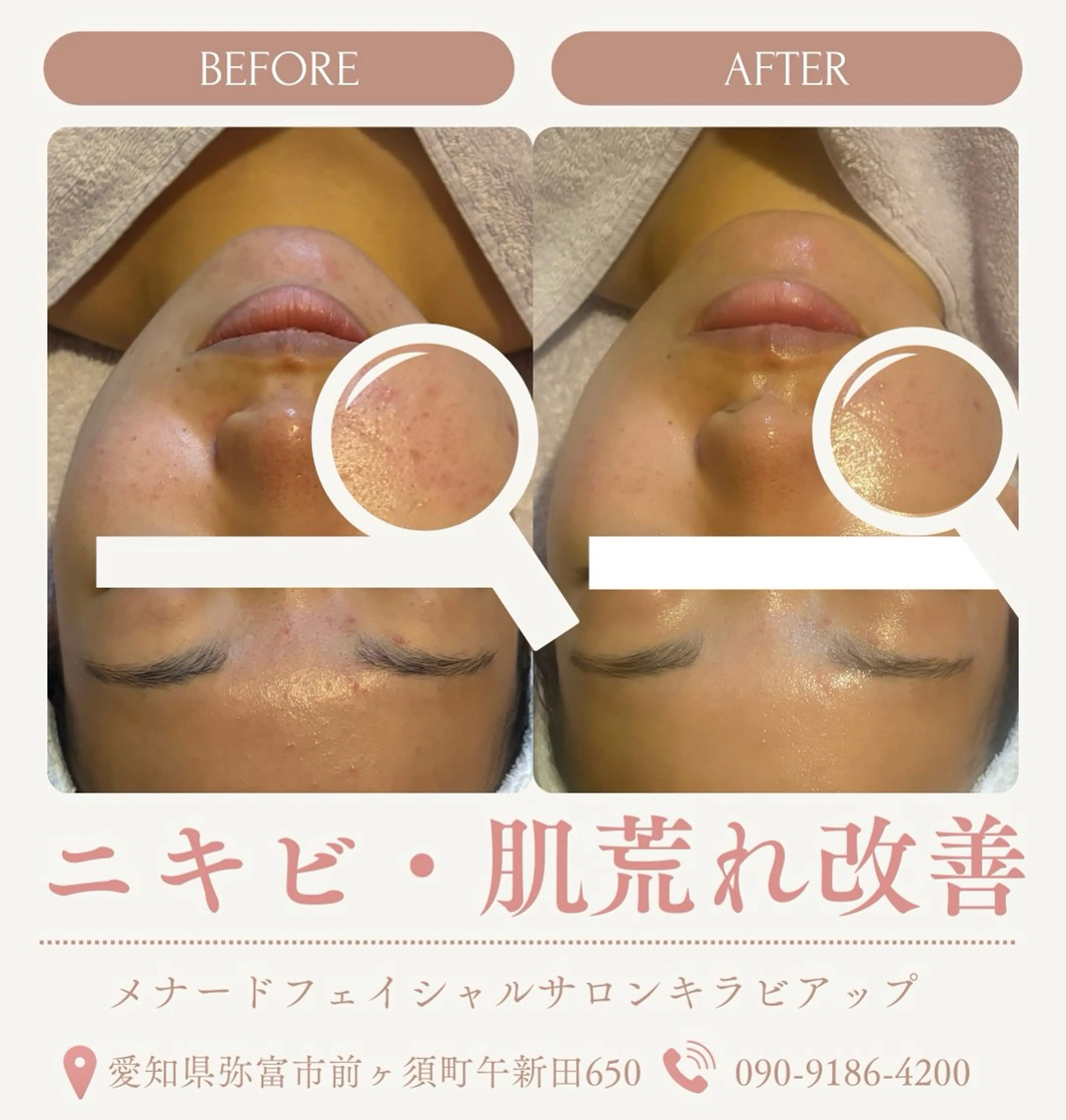 肌改善・美肌サポート 🤍tokoのエステ・リラクイメージ