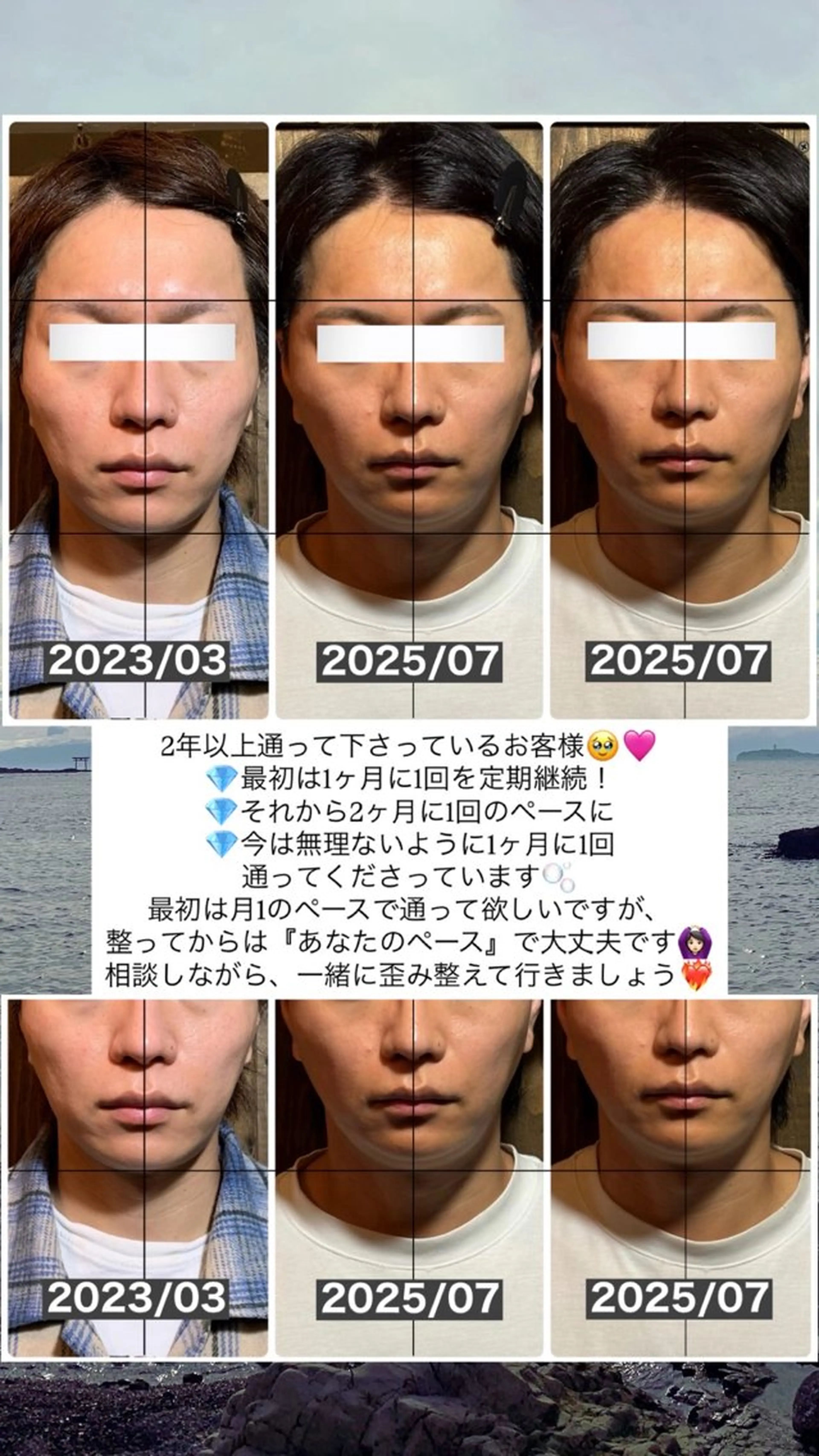 エステ リラク 💎後悔させない小顔 矯正💎イトヤマ🌱のエステ・リラクイメージ