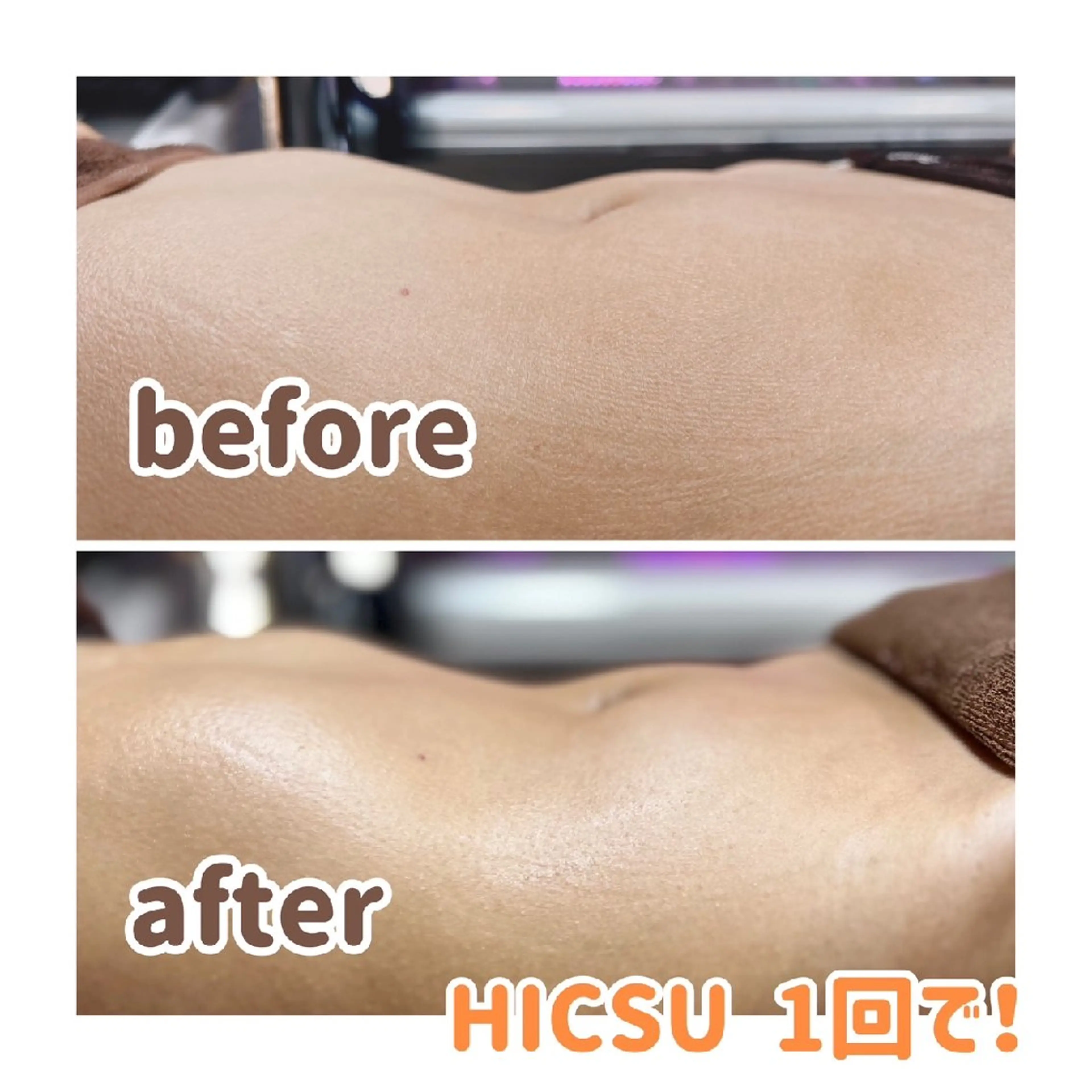 トータルビューティー サロン　Reiのエステ・リラクイメージ