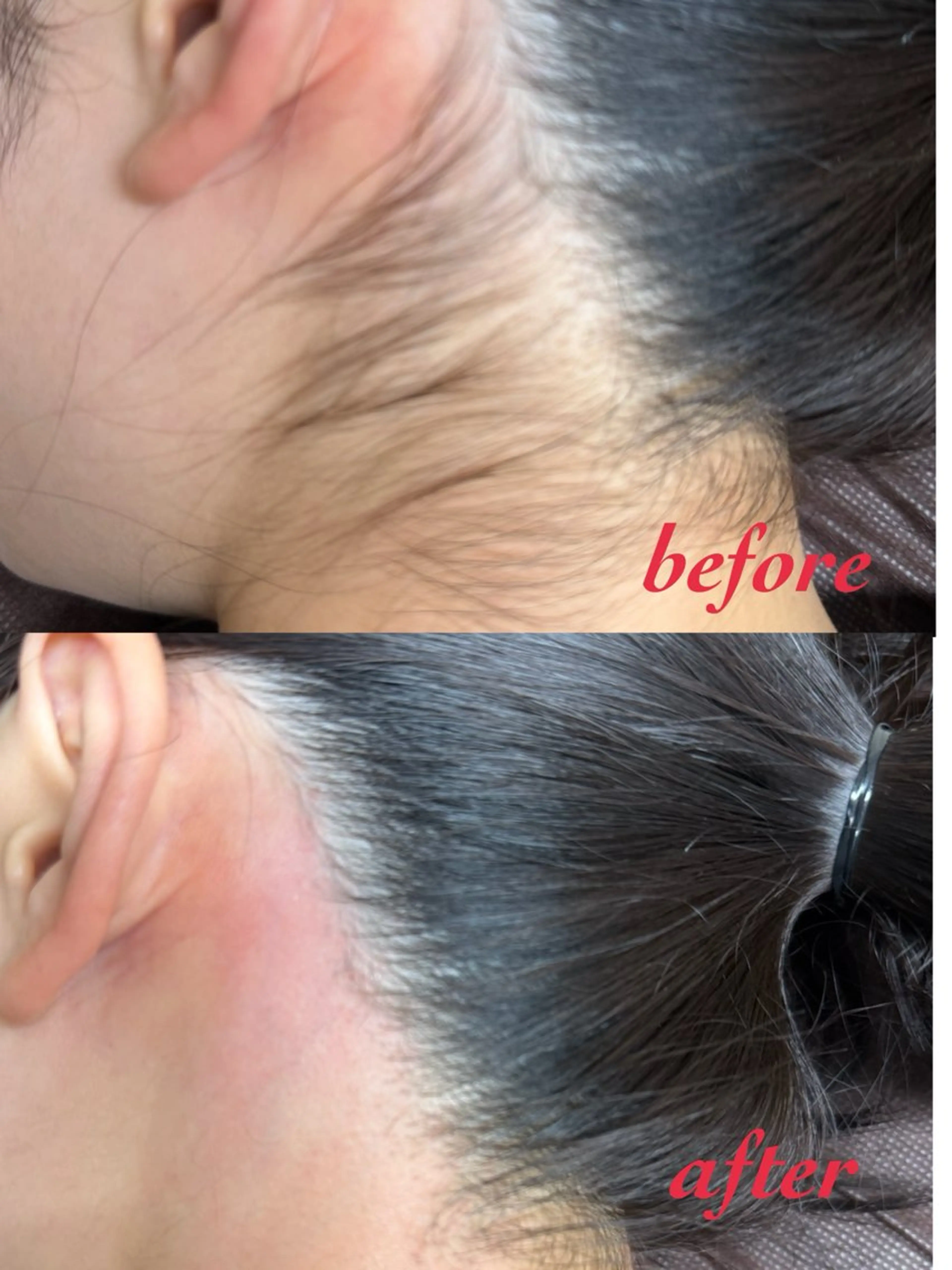 脱毛サロン CREVIOのエステ・リラクイメージ