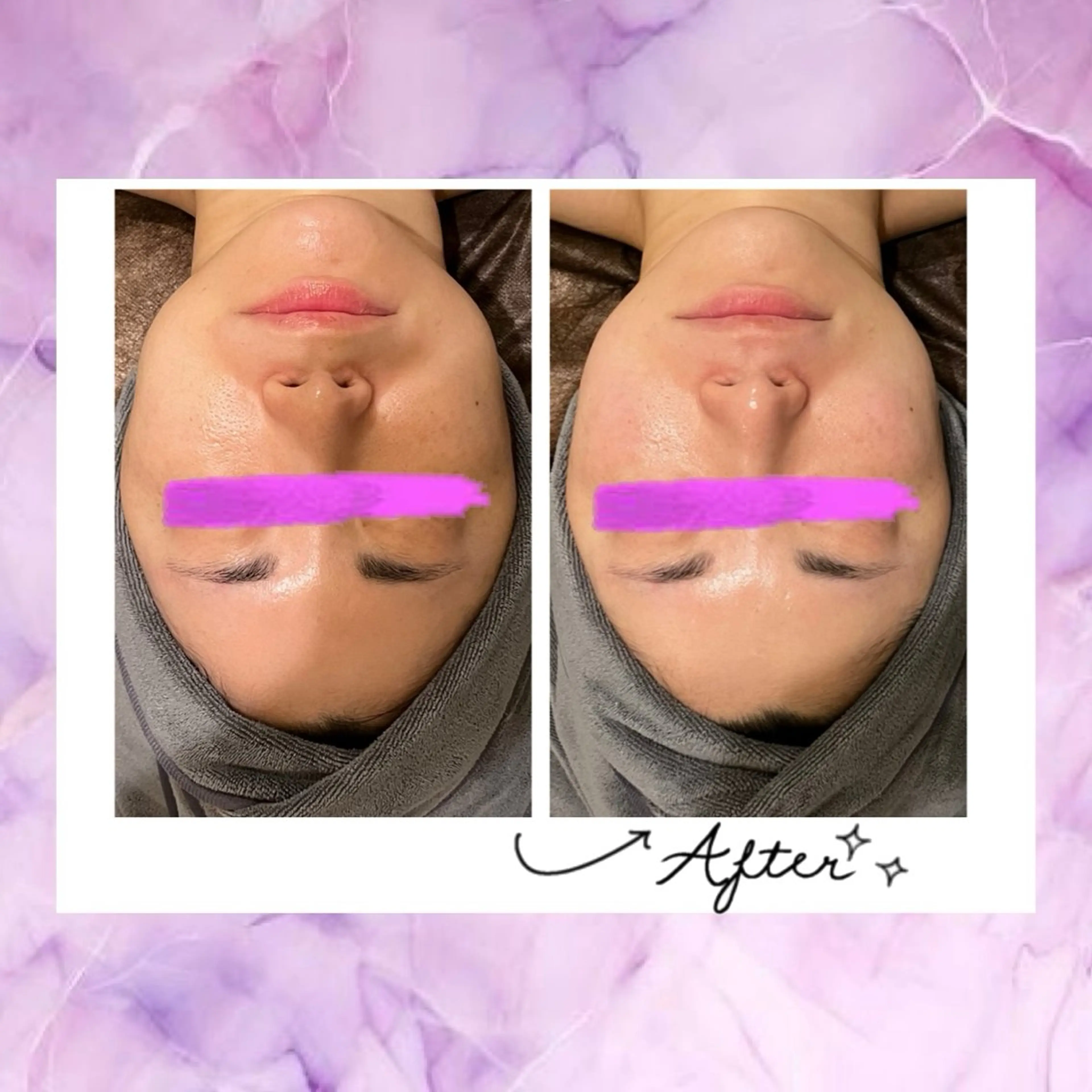 小顔コルギ ☆表参道/外苑前のエステ・リラクイメージ