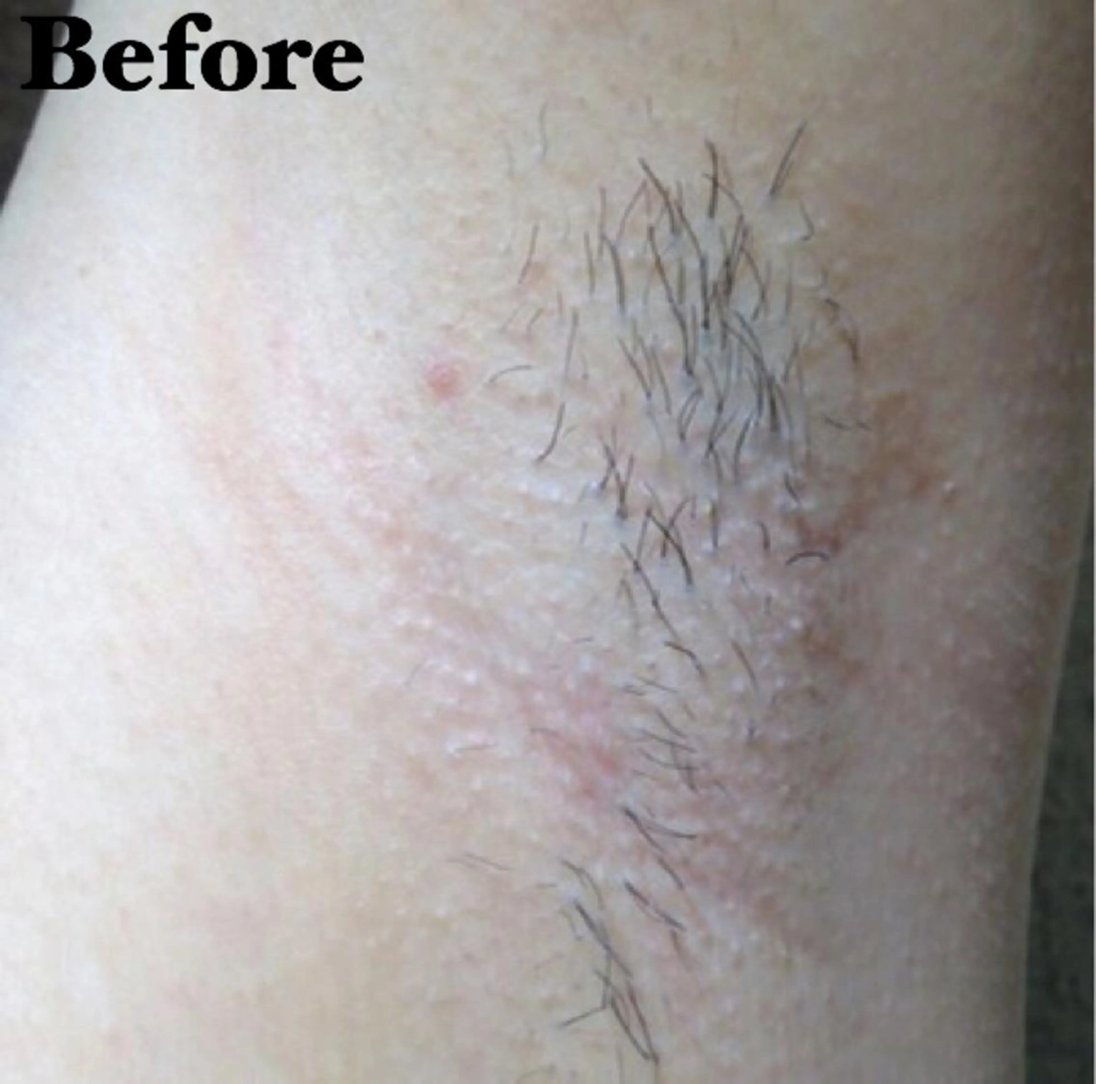 MIMI 吉祥寺本店のエステ・リラクイメージ