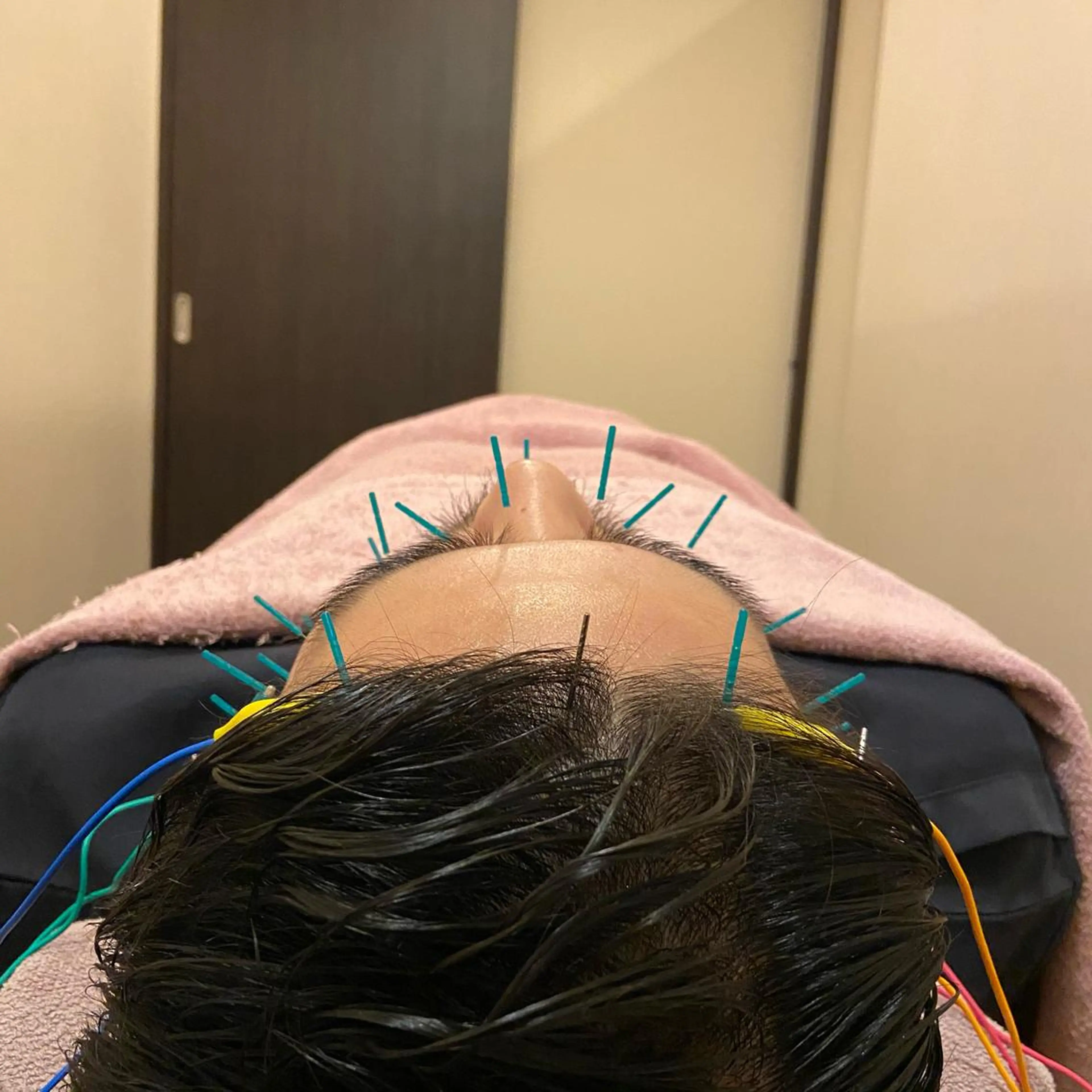 メンズ 表参道 ポルクス整骨院のエステ・リラクイメージ