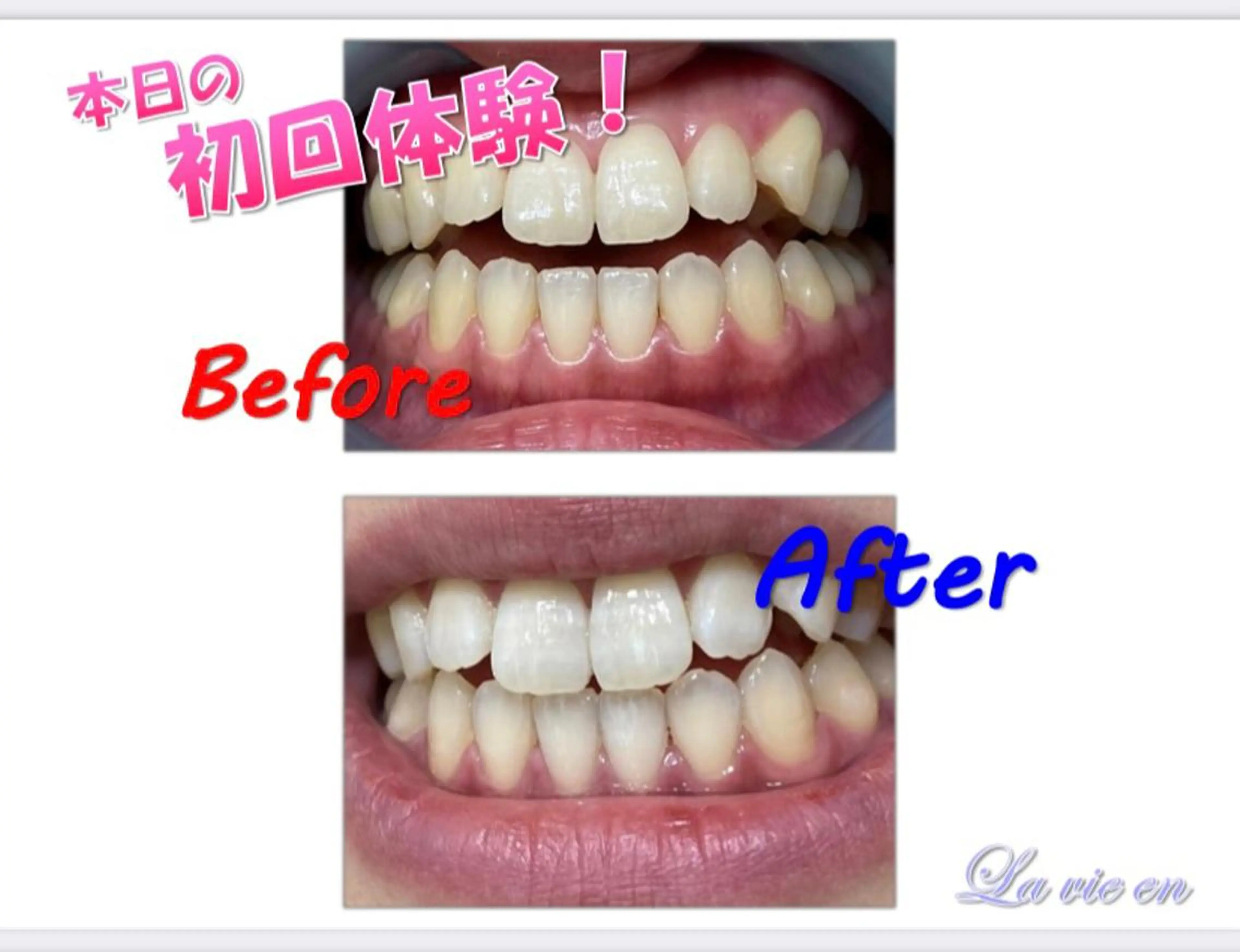 その他 ホワイトニングサロン La vie enのその他イメージ
