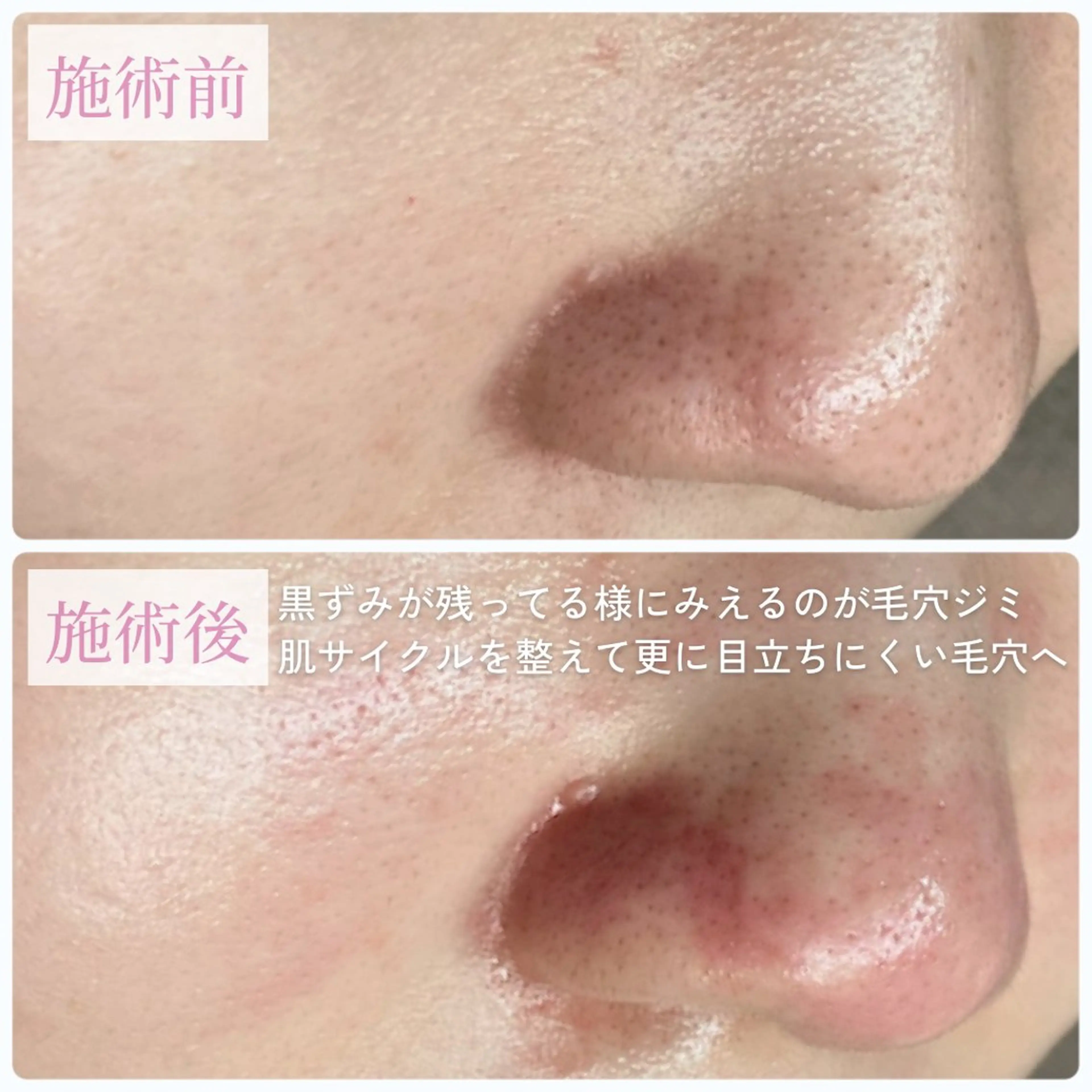 毛穴肌質ケアサロン Yourmeユアミーのエステ・リラクイメージ