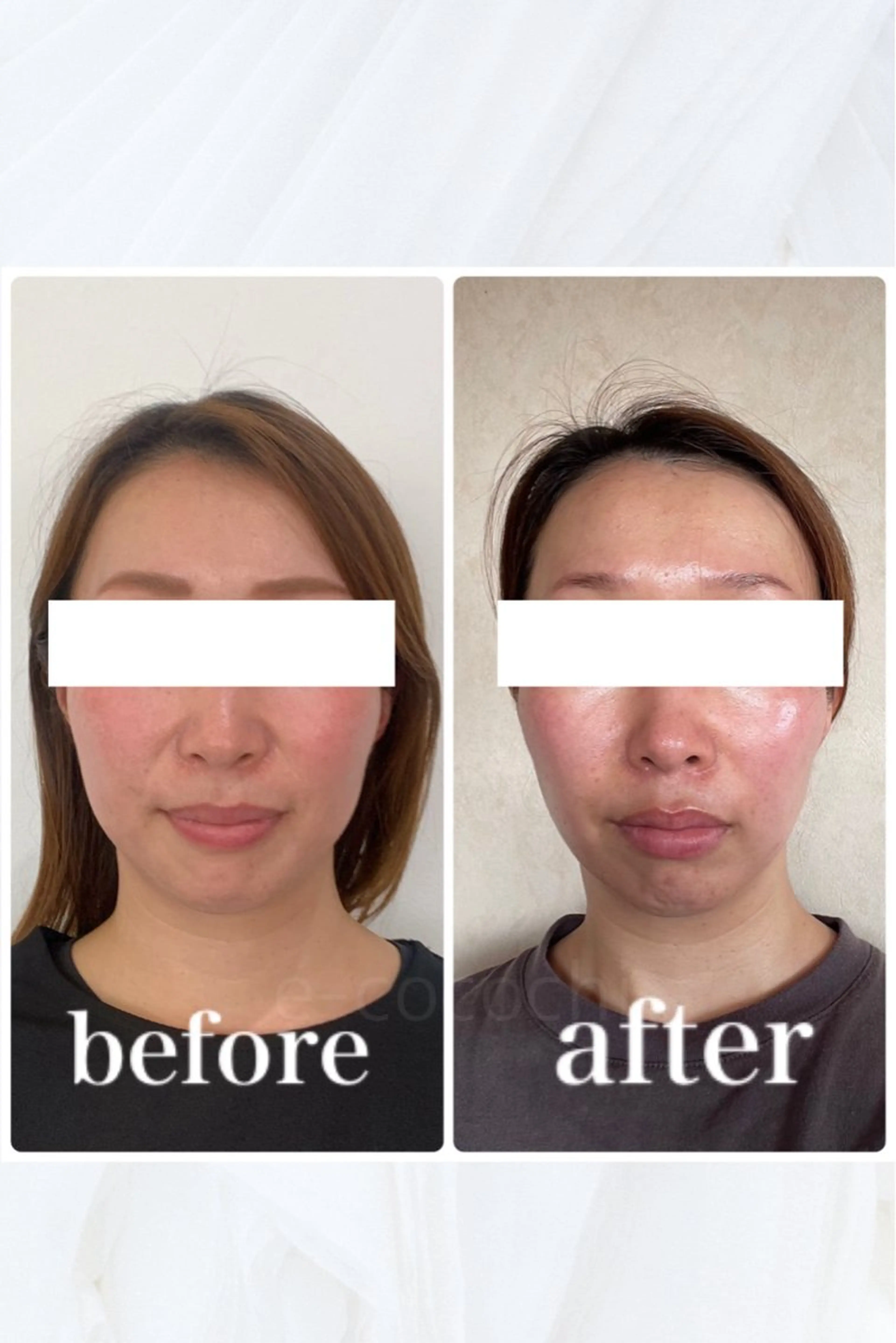 エステ リラク 小顔と ヘッドスパのお店のエステ・リラクイメージ