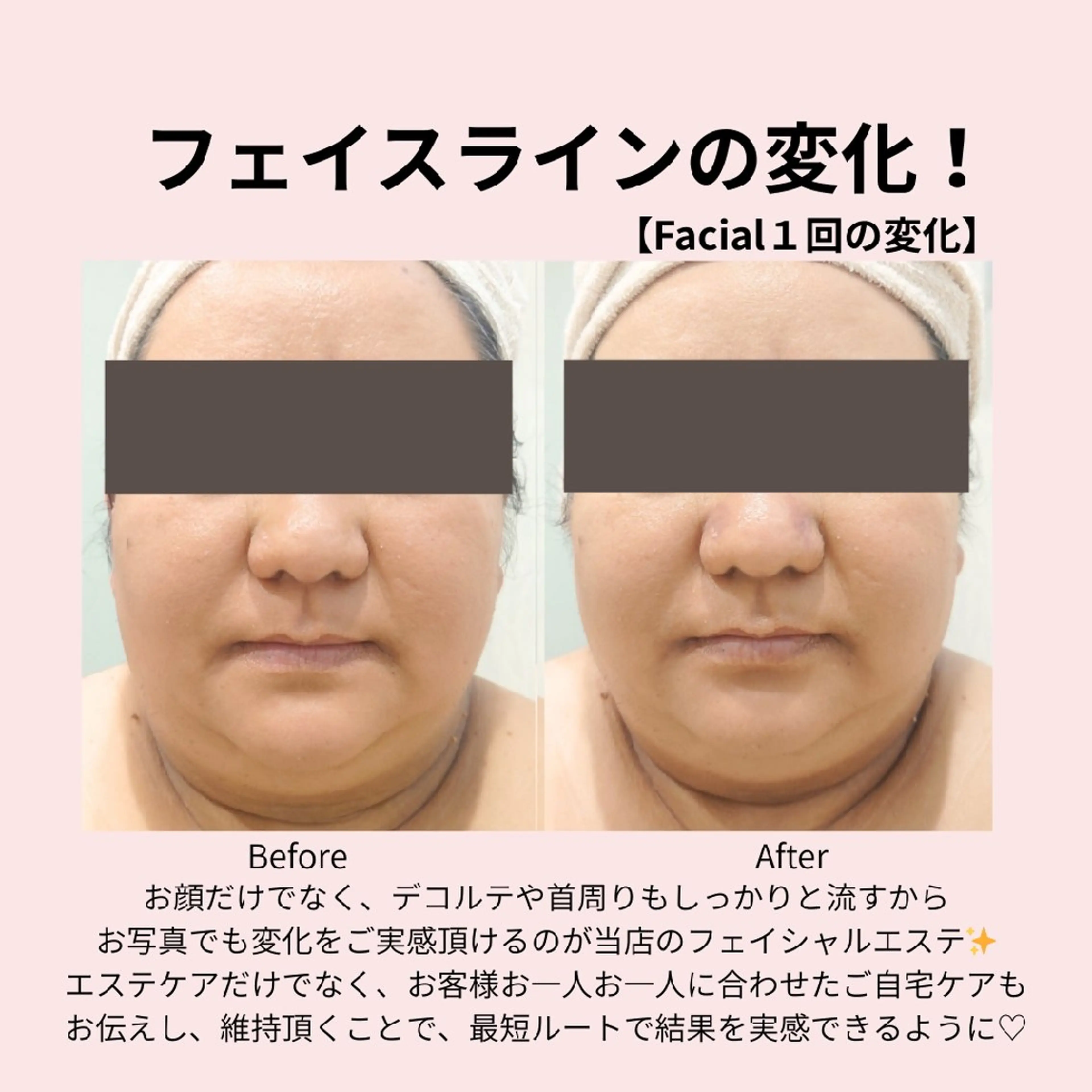 エステ PRETTIEST SHINE所属・フェイシャル/ボディ /ブライダル山田浩子のエステ・リラクイメージ