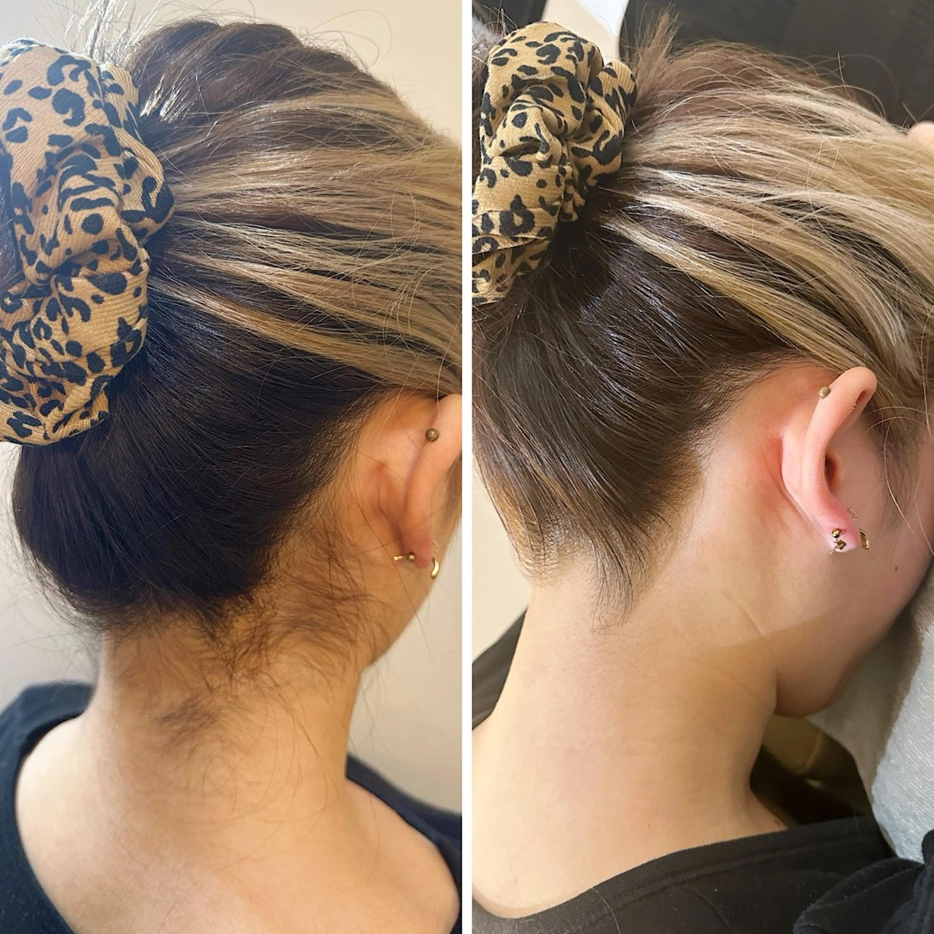 脱毛 うなじ脱毛/美肌脱毛 LABELのエステ・リラクイメージ