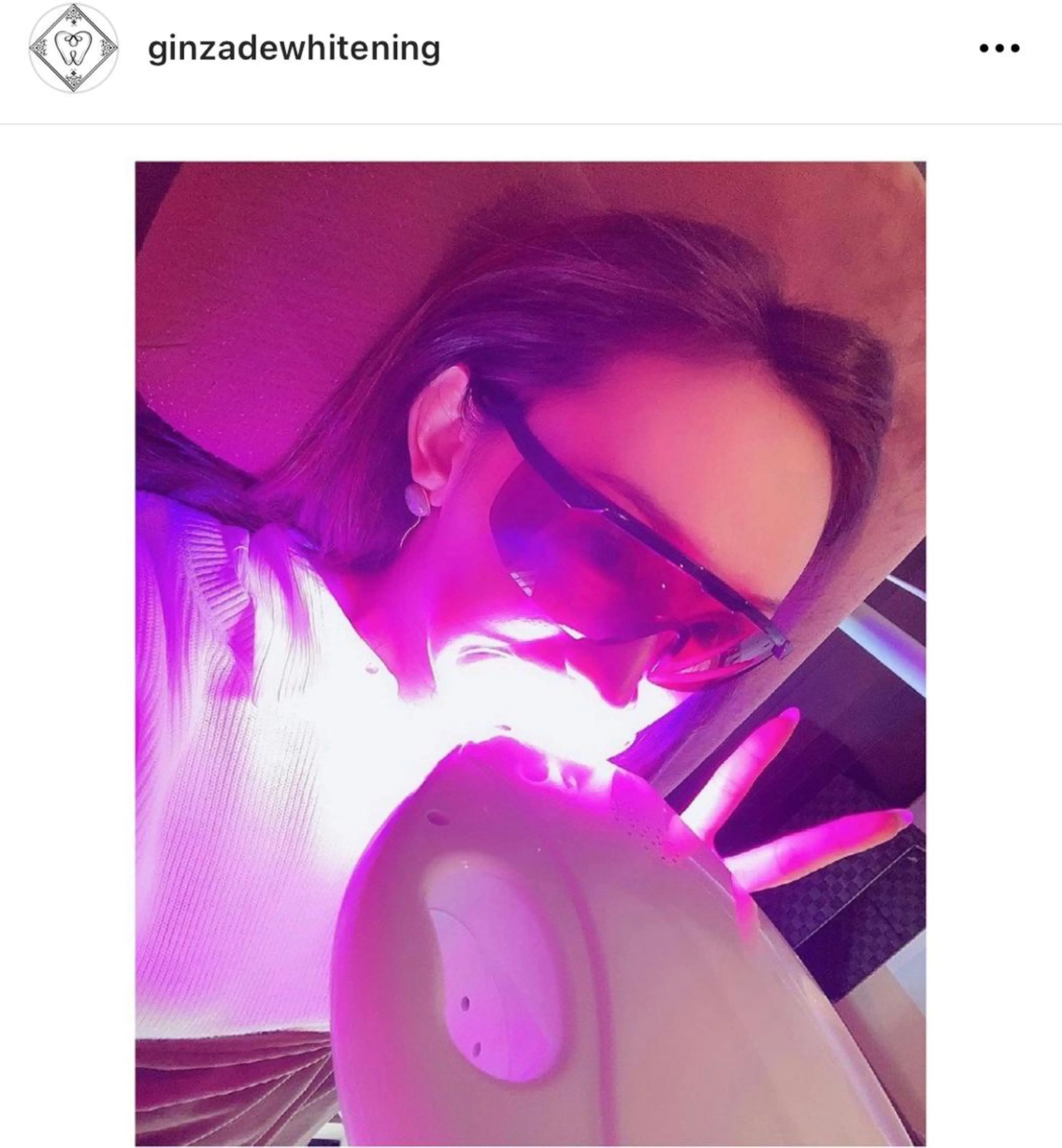 銀座de ホワイトニングのその他イメージ