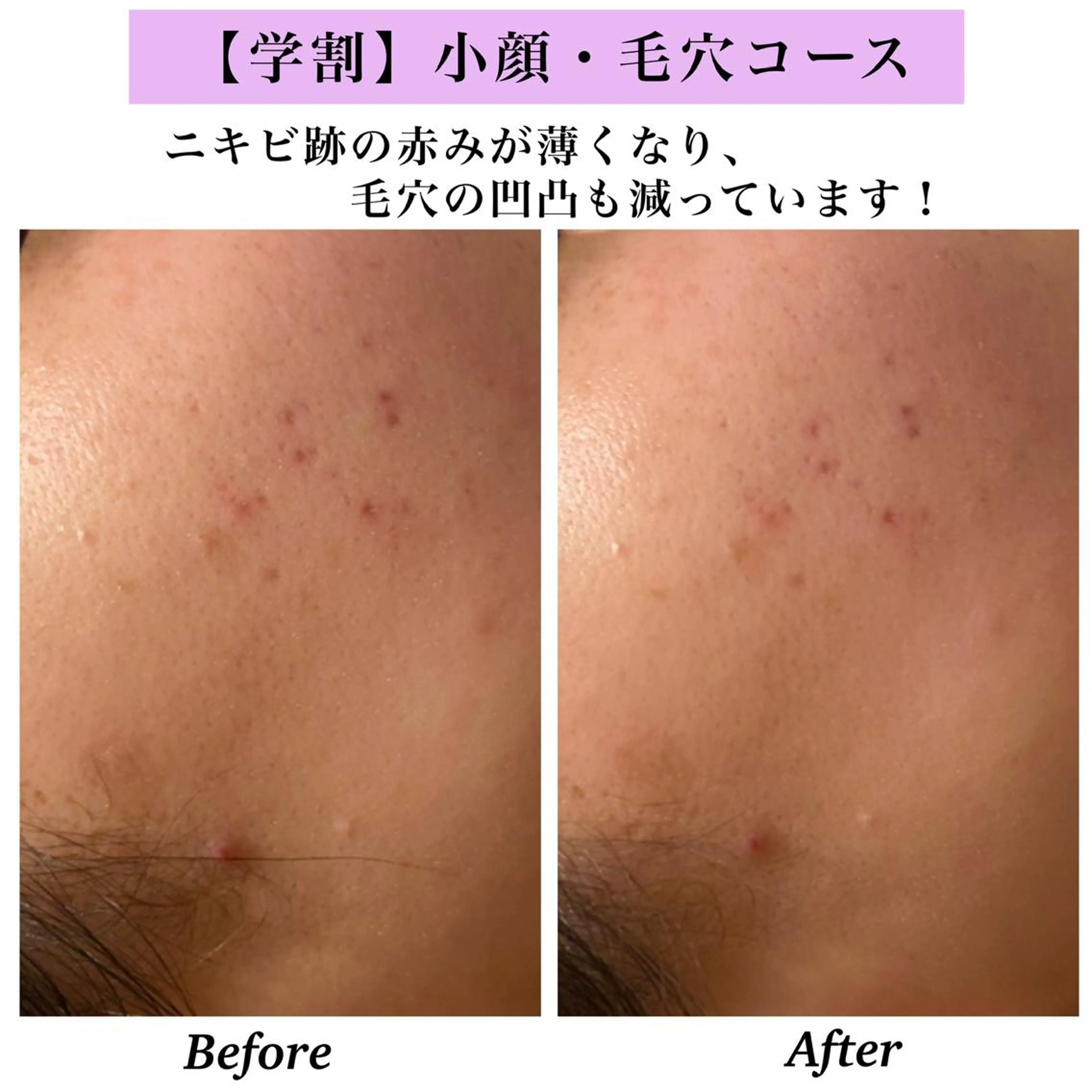 Bellesthe （ベルエステ）のエステ・リラクイメージ