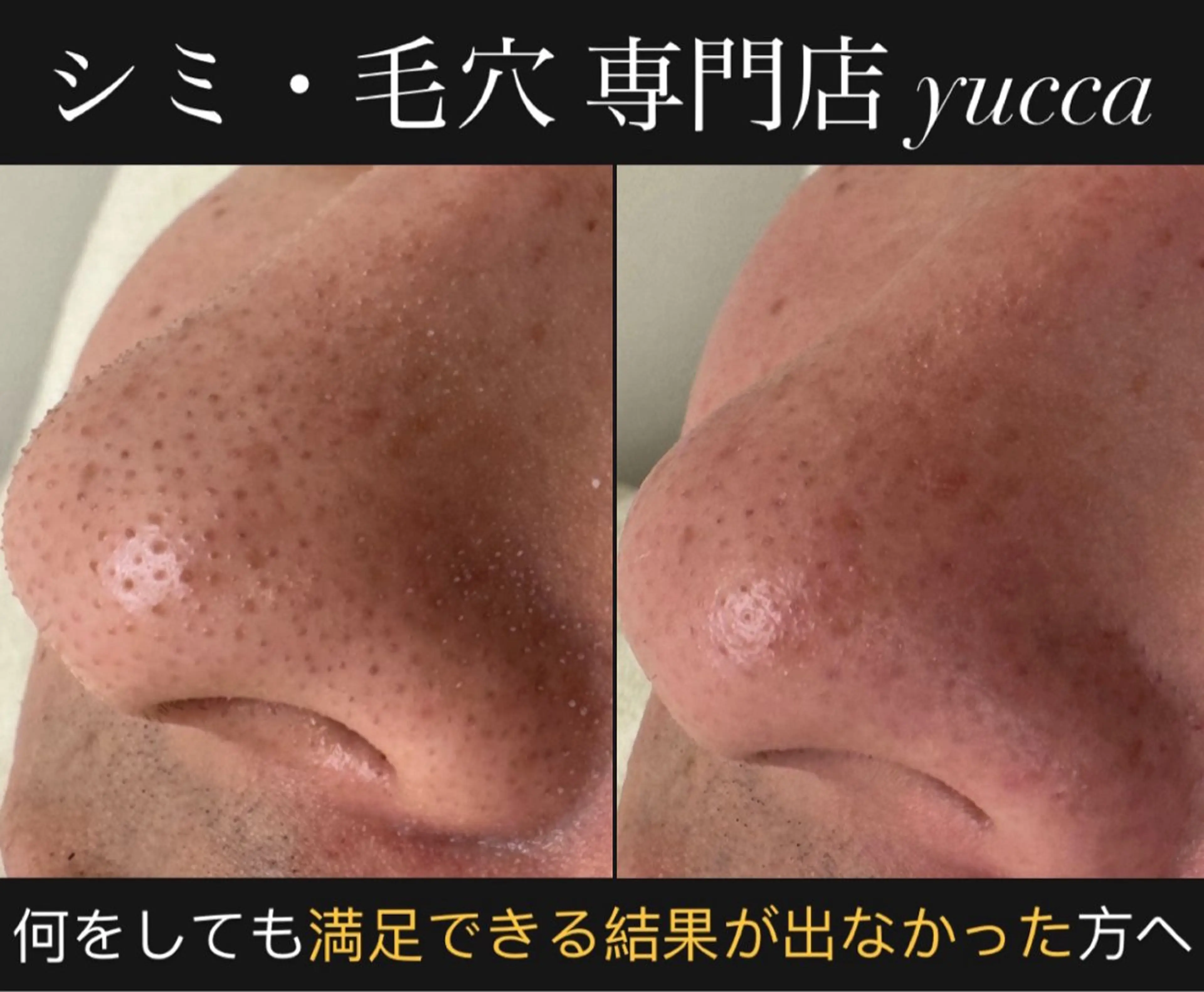 エステ リラク シミ毛穴専門店 yucca(ユッカ)のエステ・リラクイメージ