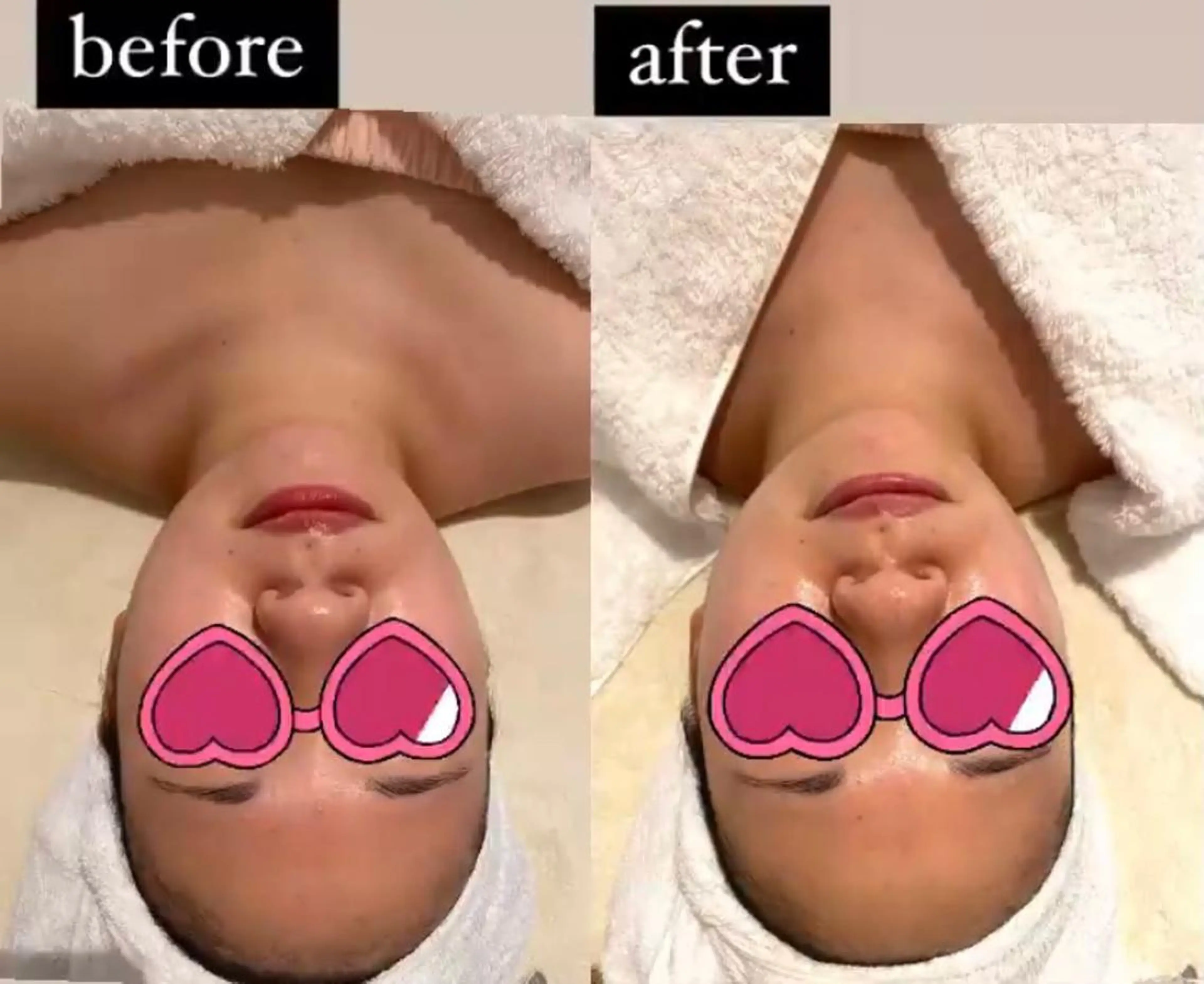 エステ リラク MENARD BLOOMのエステ・リラクイメージ