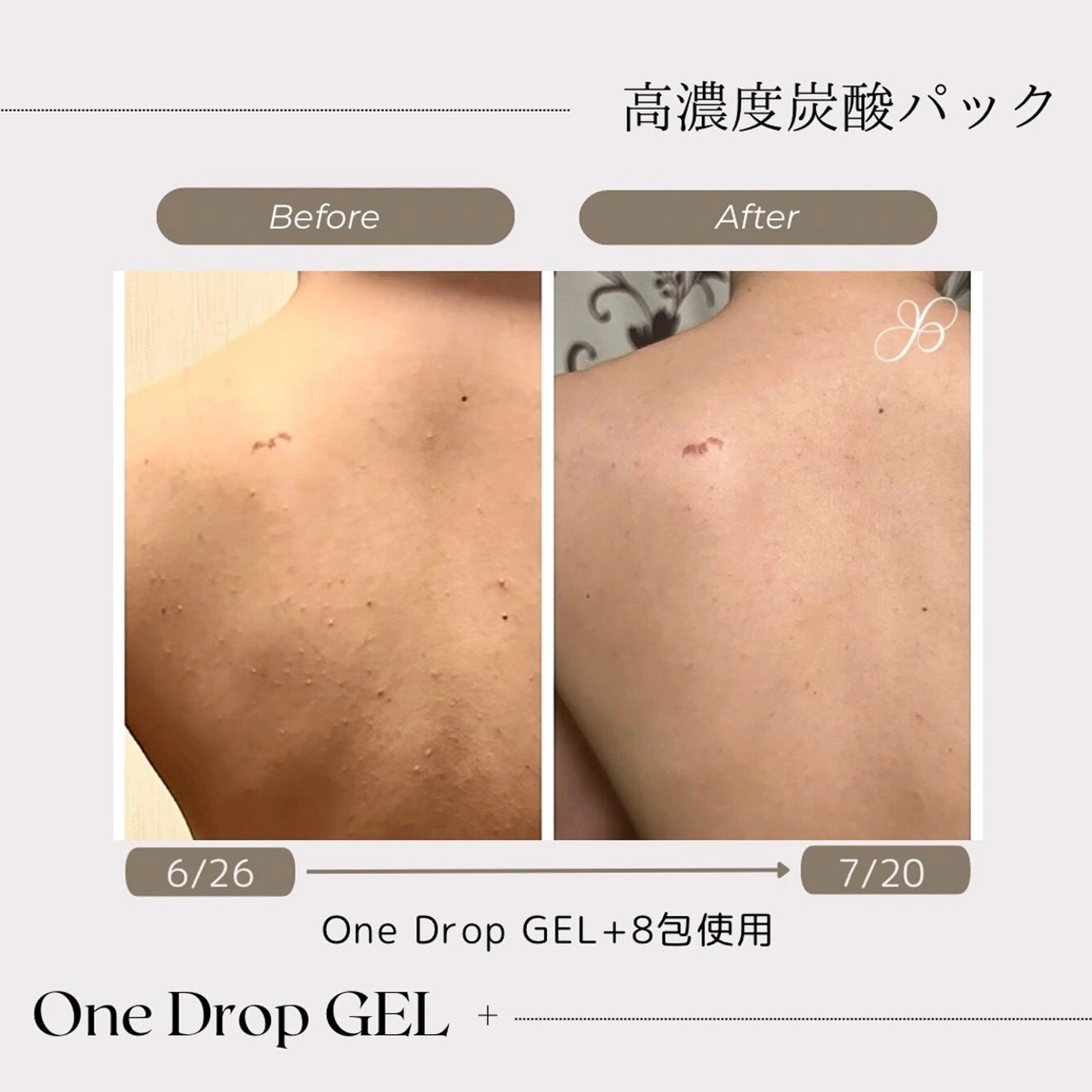 medical salon de off 堺東店所属・メディカルサロンド オフ🧸YUSAのエステ・リラクイメージ