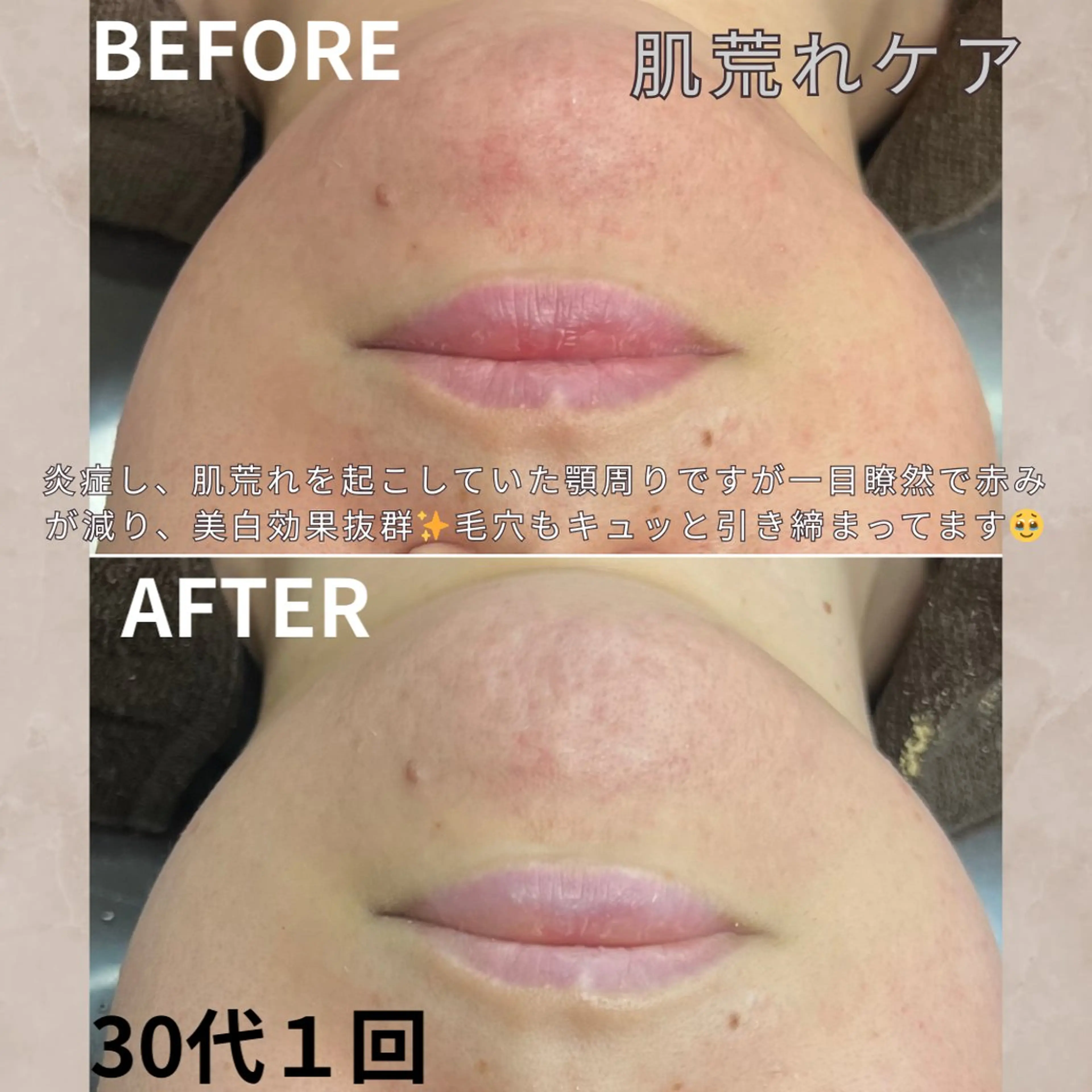 大橋 唯のエステ・リラクイメージ