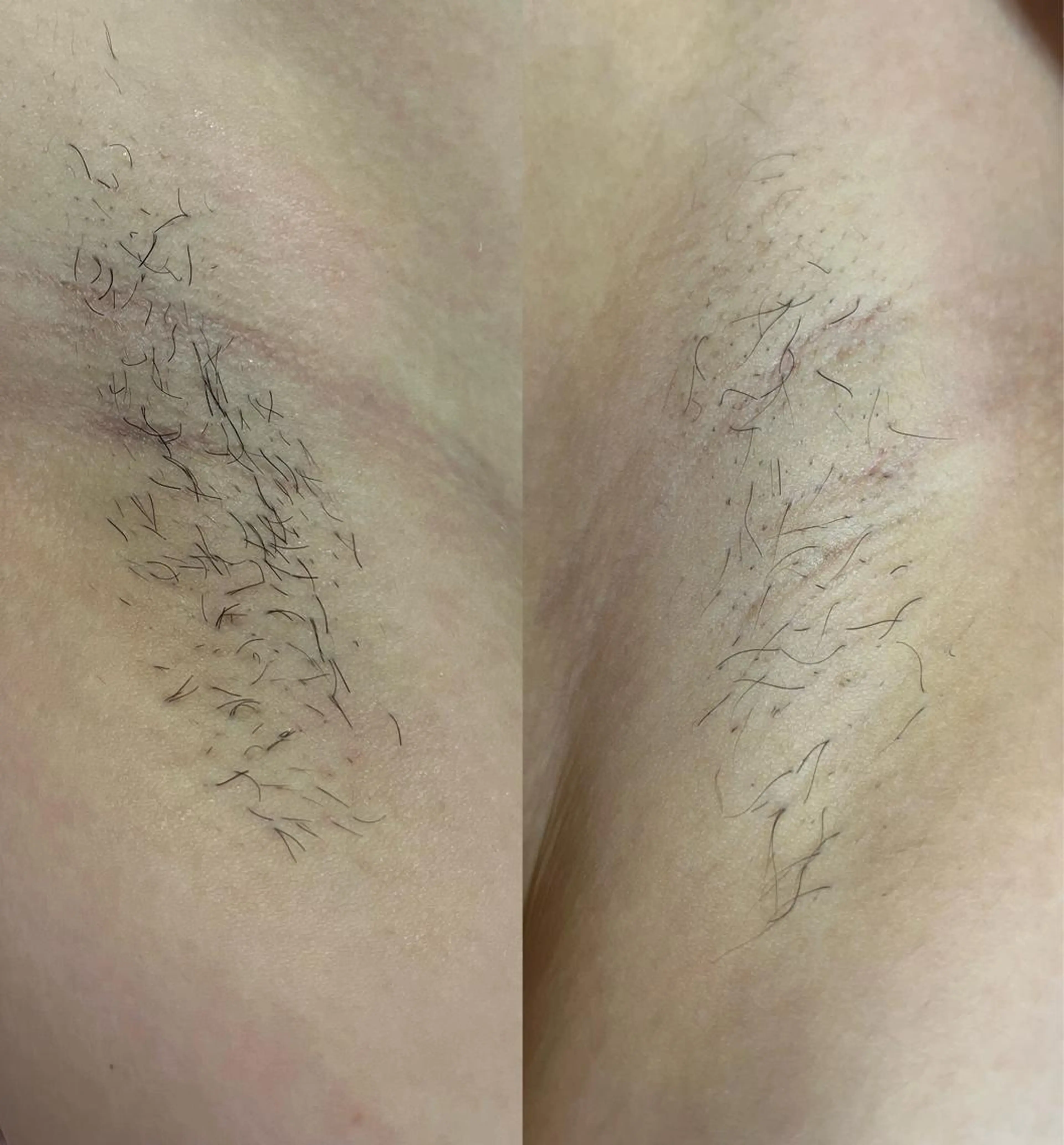 うえつま ふみえのエステ・リラクイメージ