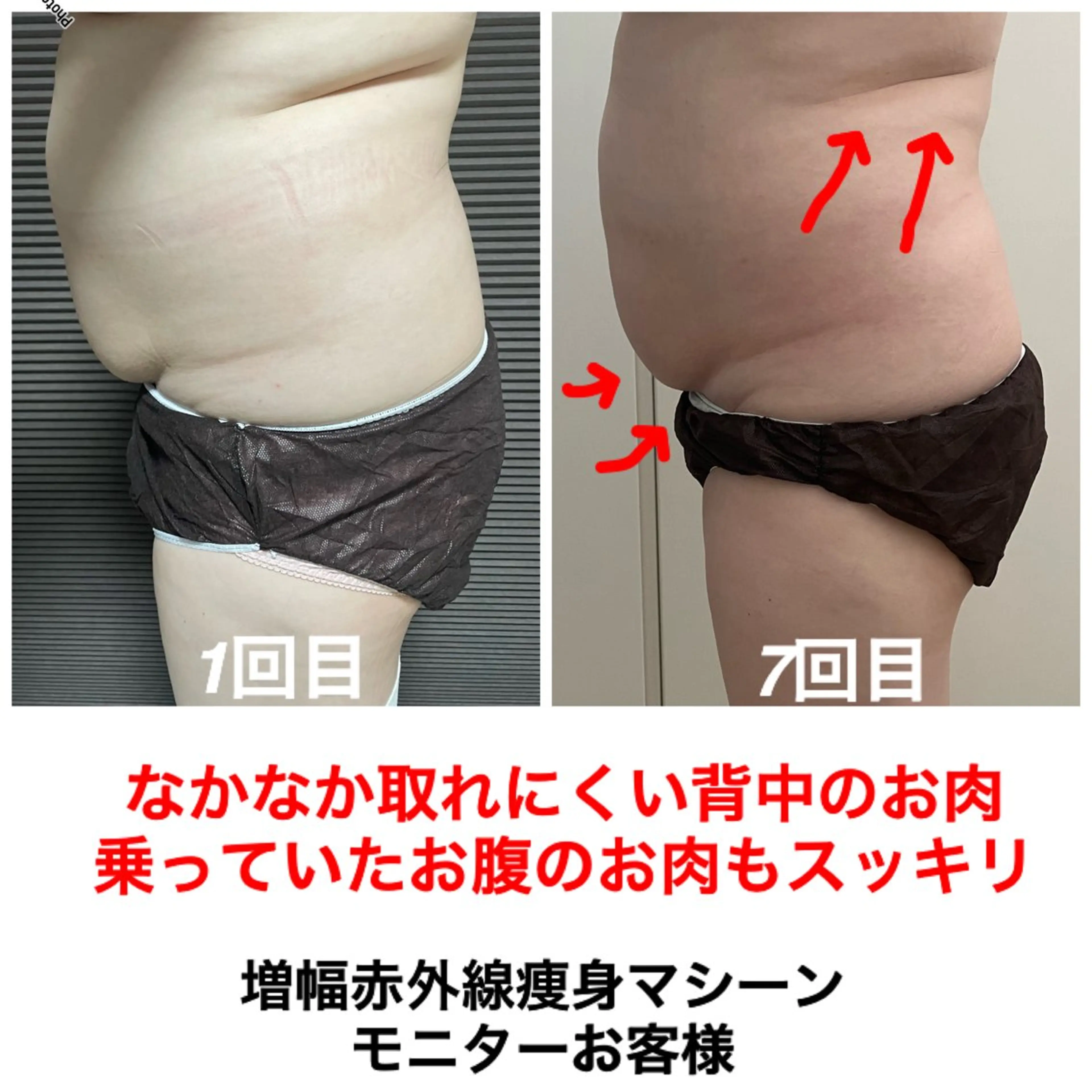 エステ ネイル・エステサロン UILANIのネイルデザイン