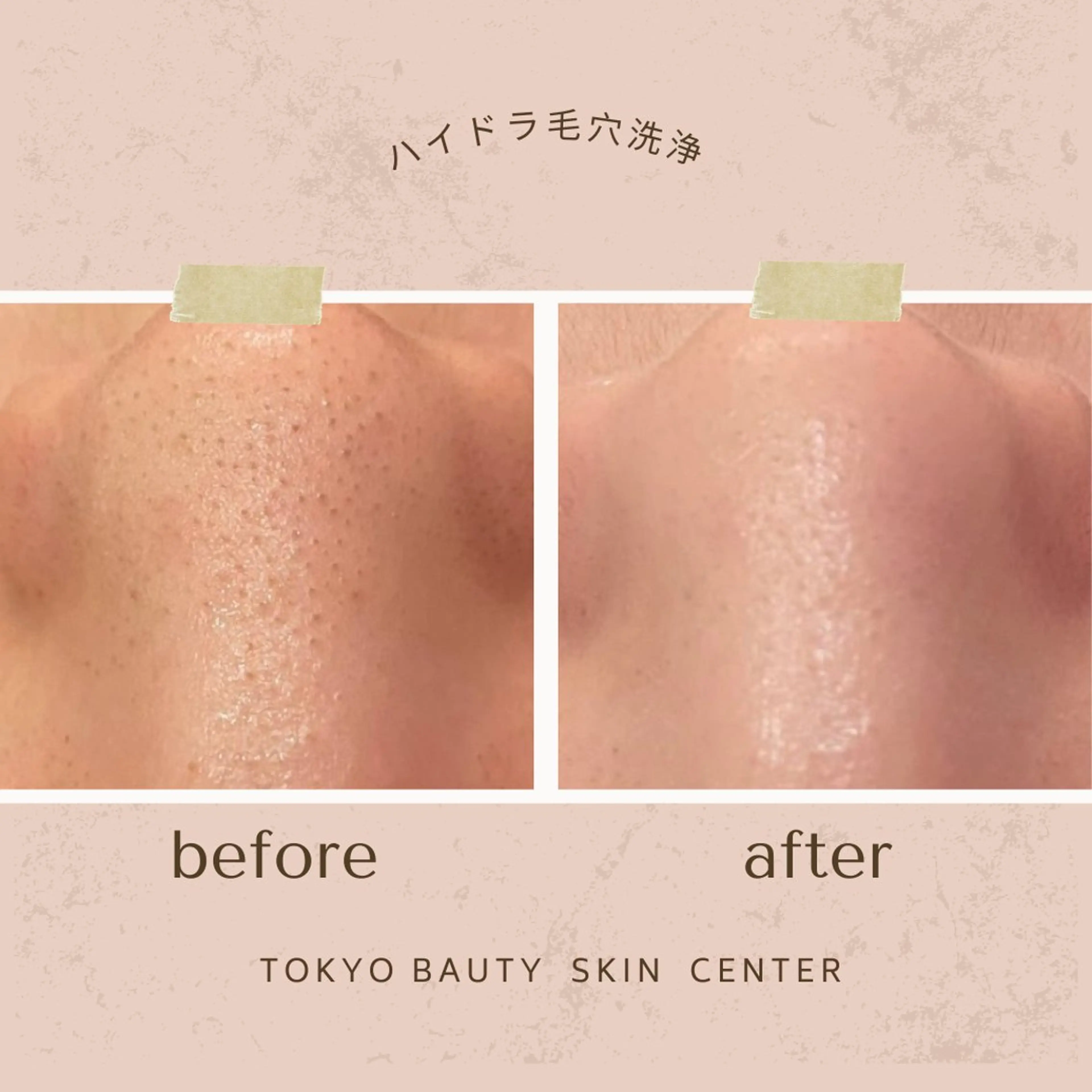 韓国肌管理& ワックス脱毛のエステ・リラクイメージ