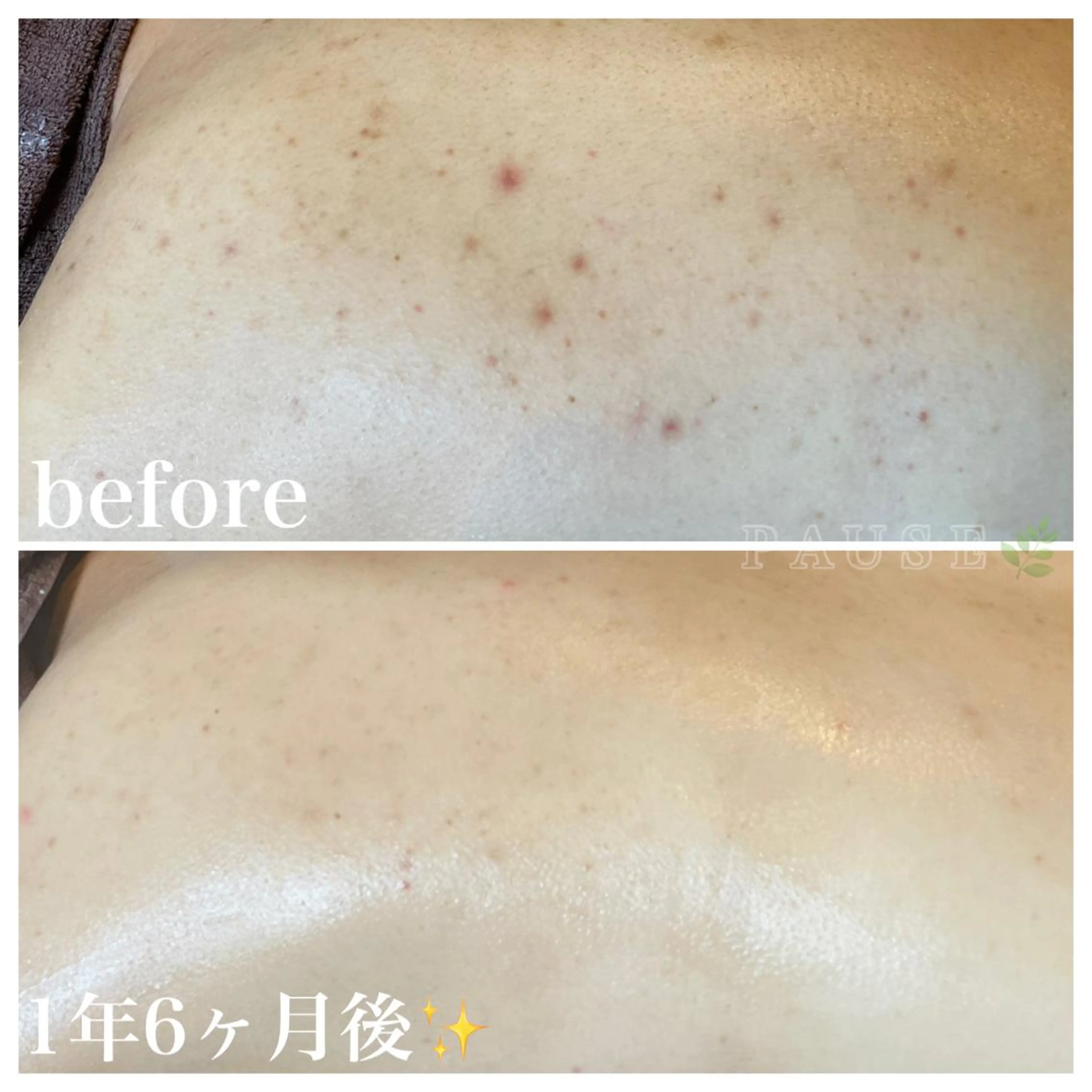 エステ 浜野 恵美のエステ・リラクイメージ