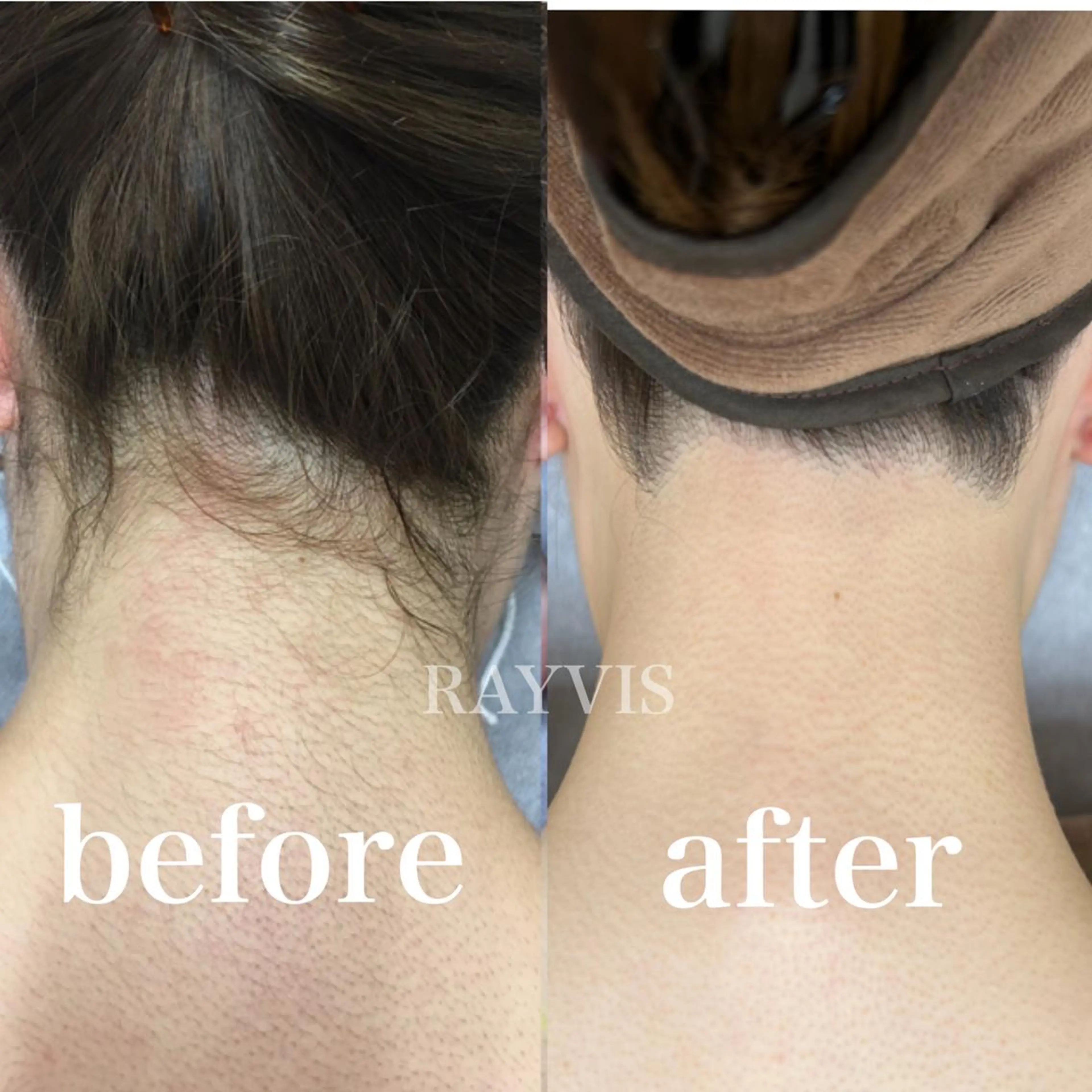 RAYVIS 郡山店のエステ・リラクイメージ