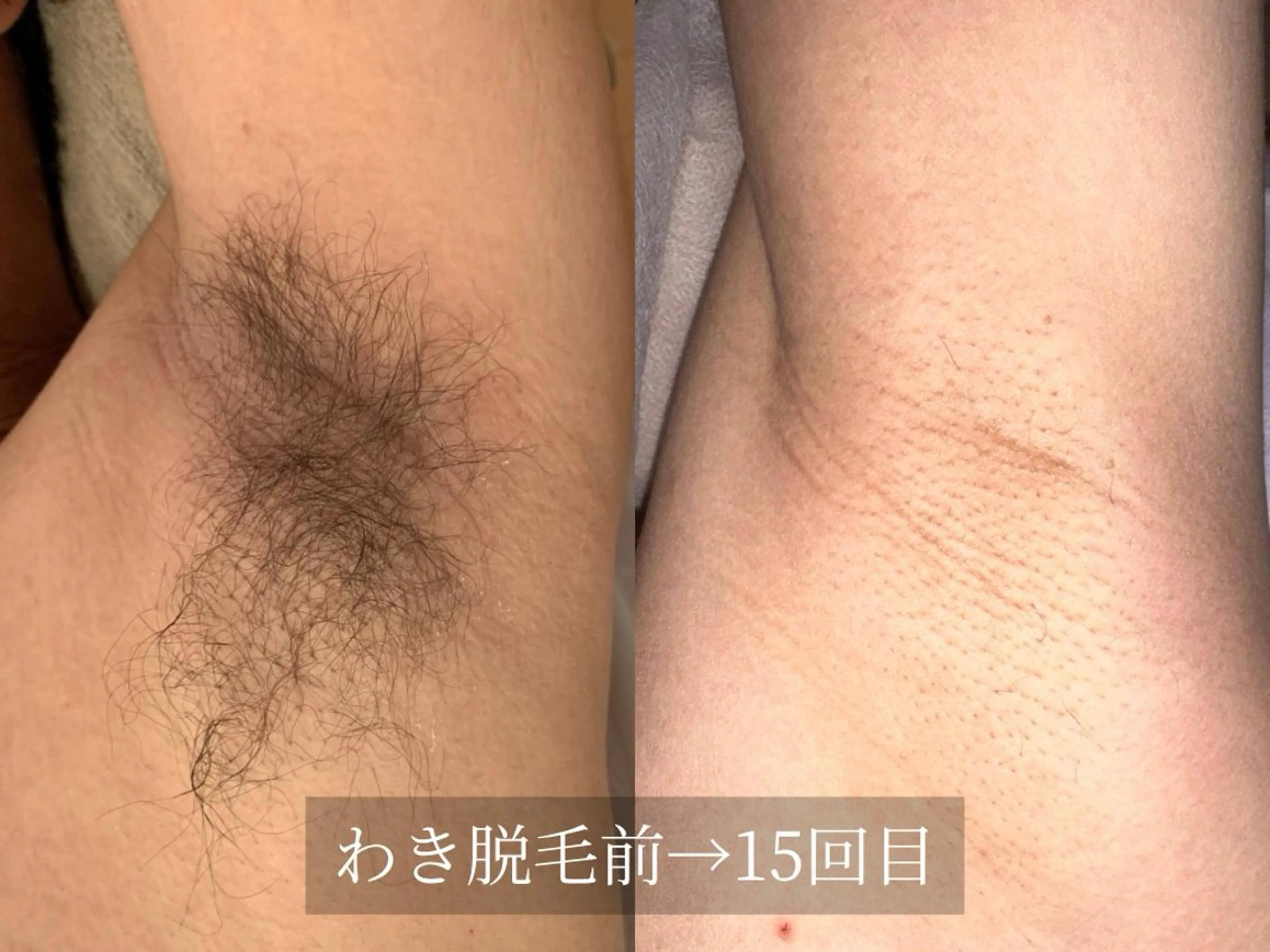 脱毛サロン Arumのエステ・リラクイメージ