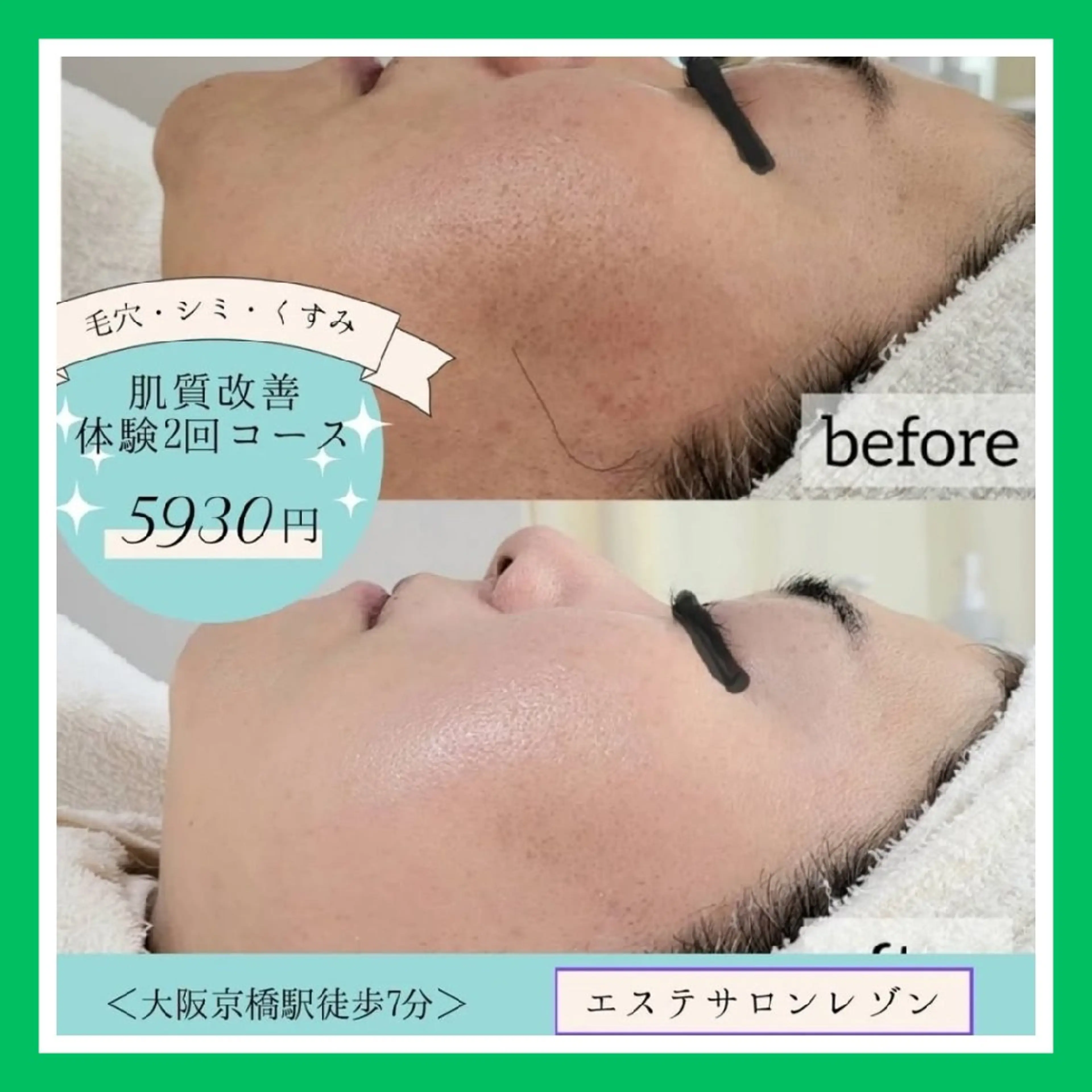 【40歳以上の方に人気💞】透明感UP✨くすみ＆たるみケア 2回体験 ¥6,930の写真