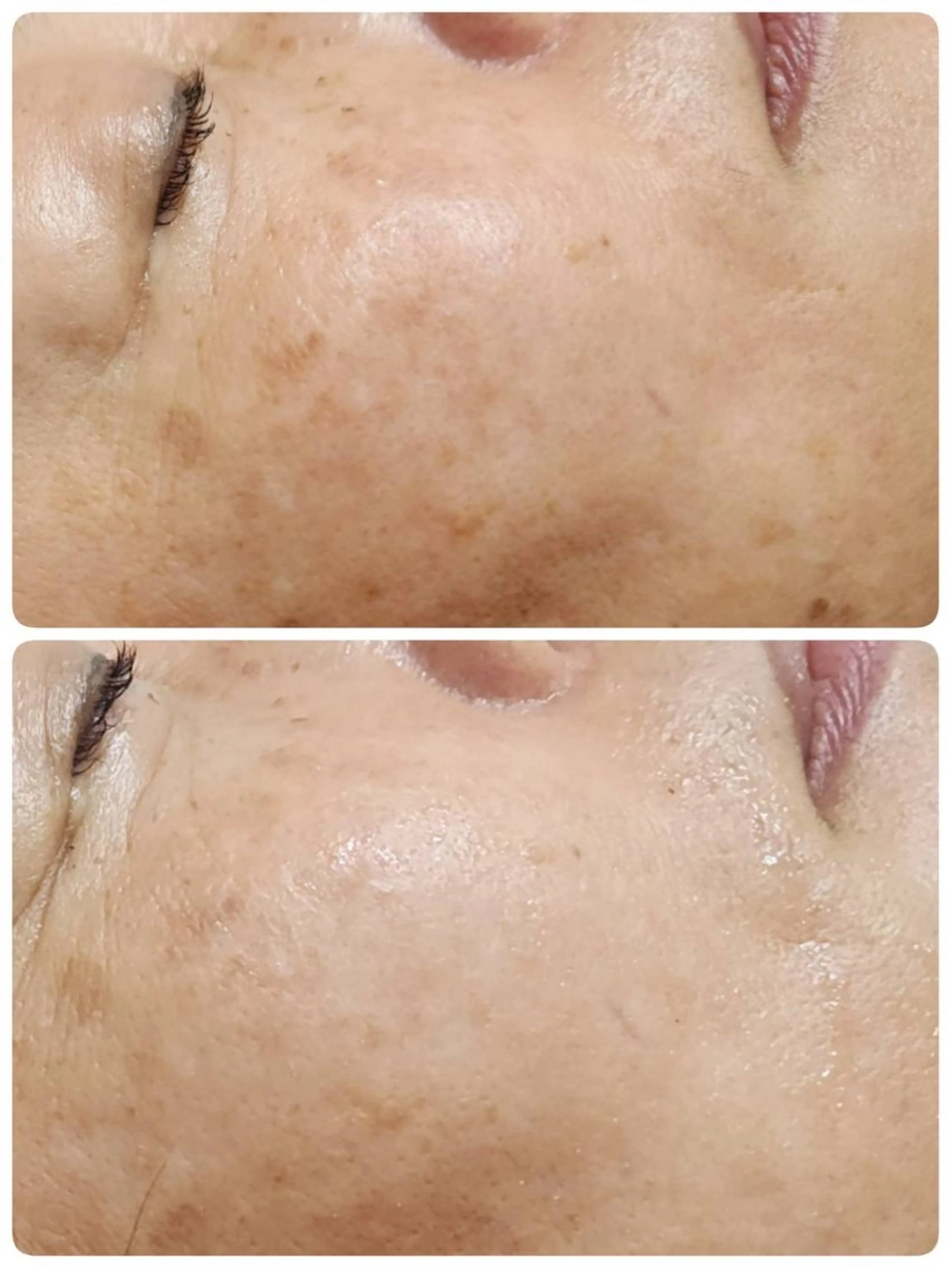 エステ yomu所属・yomu Rikaのエステ・リラクイメージ