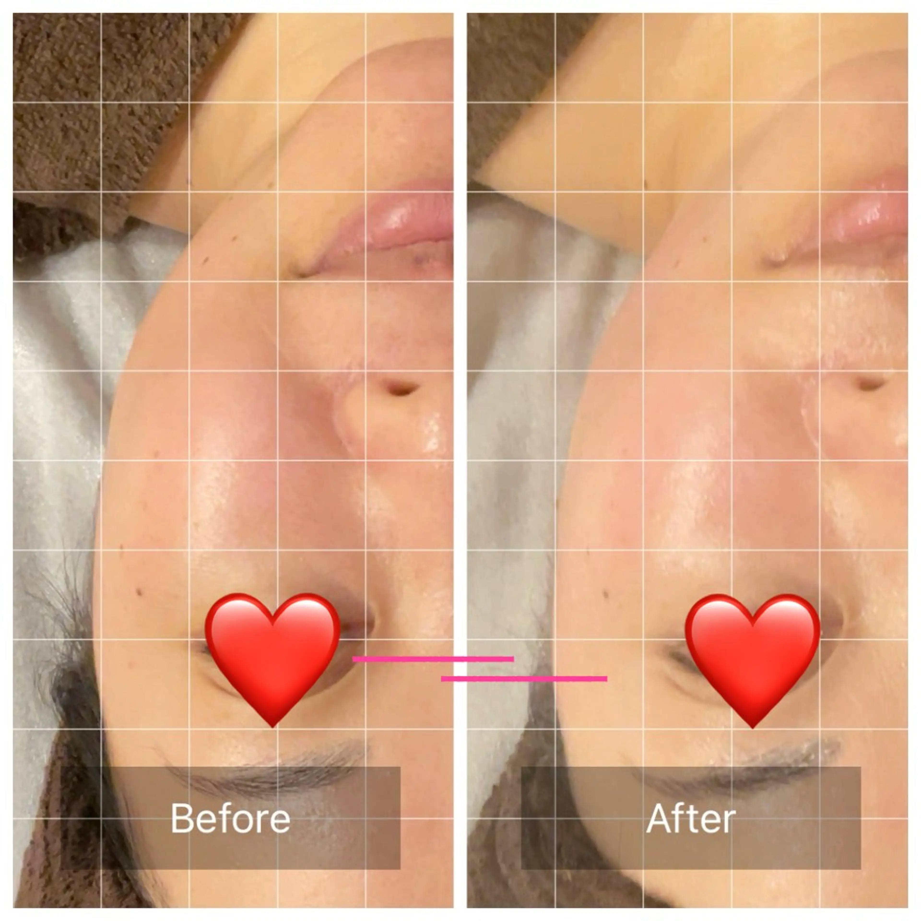 エステ リラク アロマリンパ/リフト アップ小顔CALMEのエステ・リラクイメージ