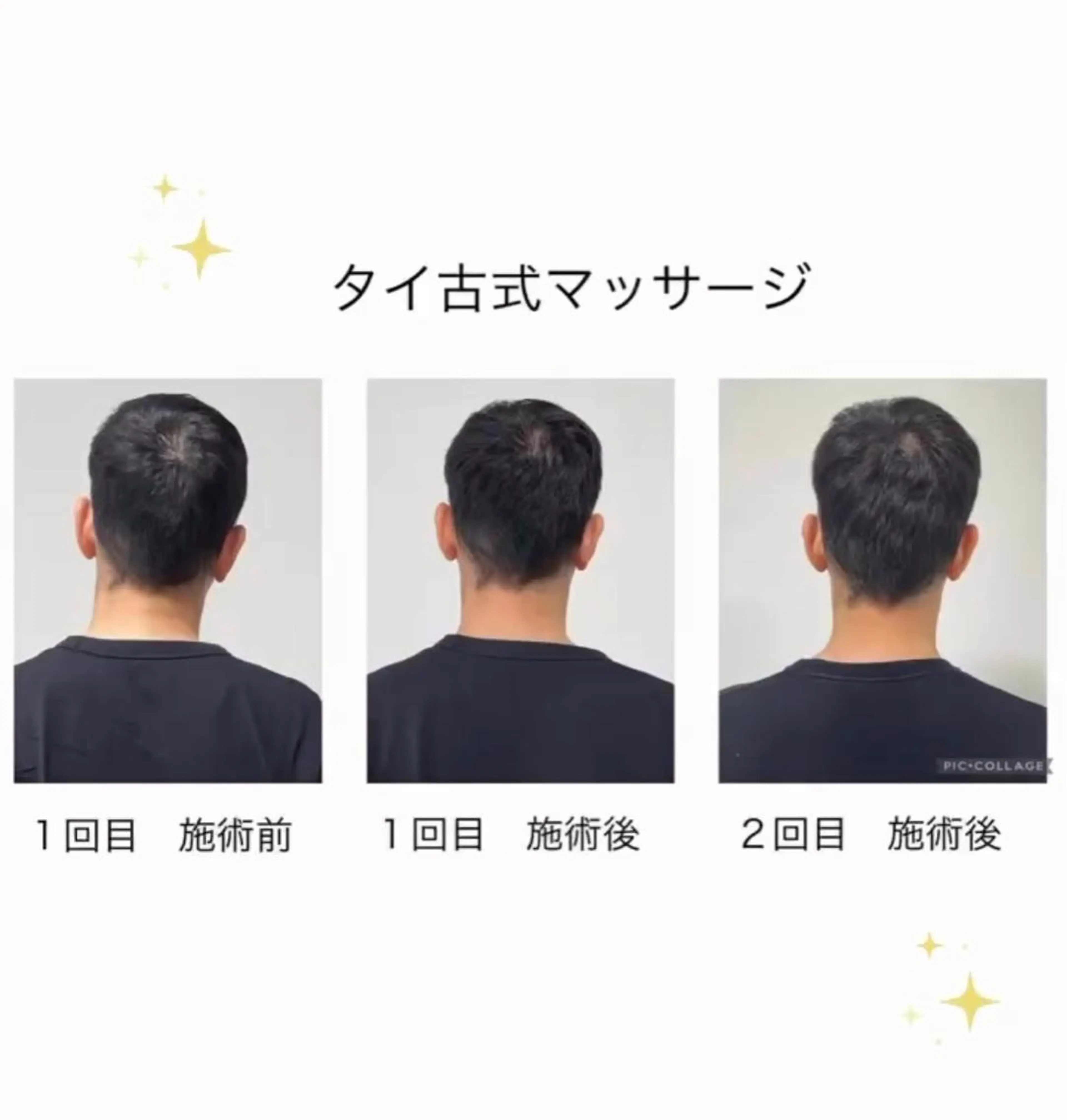 Uniリラクゼーション下北沢所属・aya kaのエステ・リラクイメージ