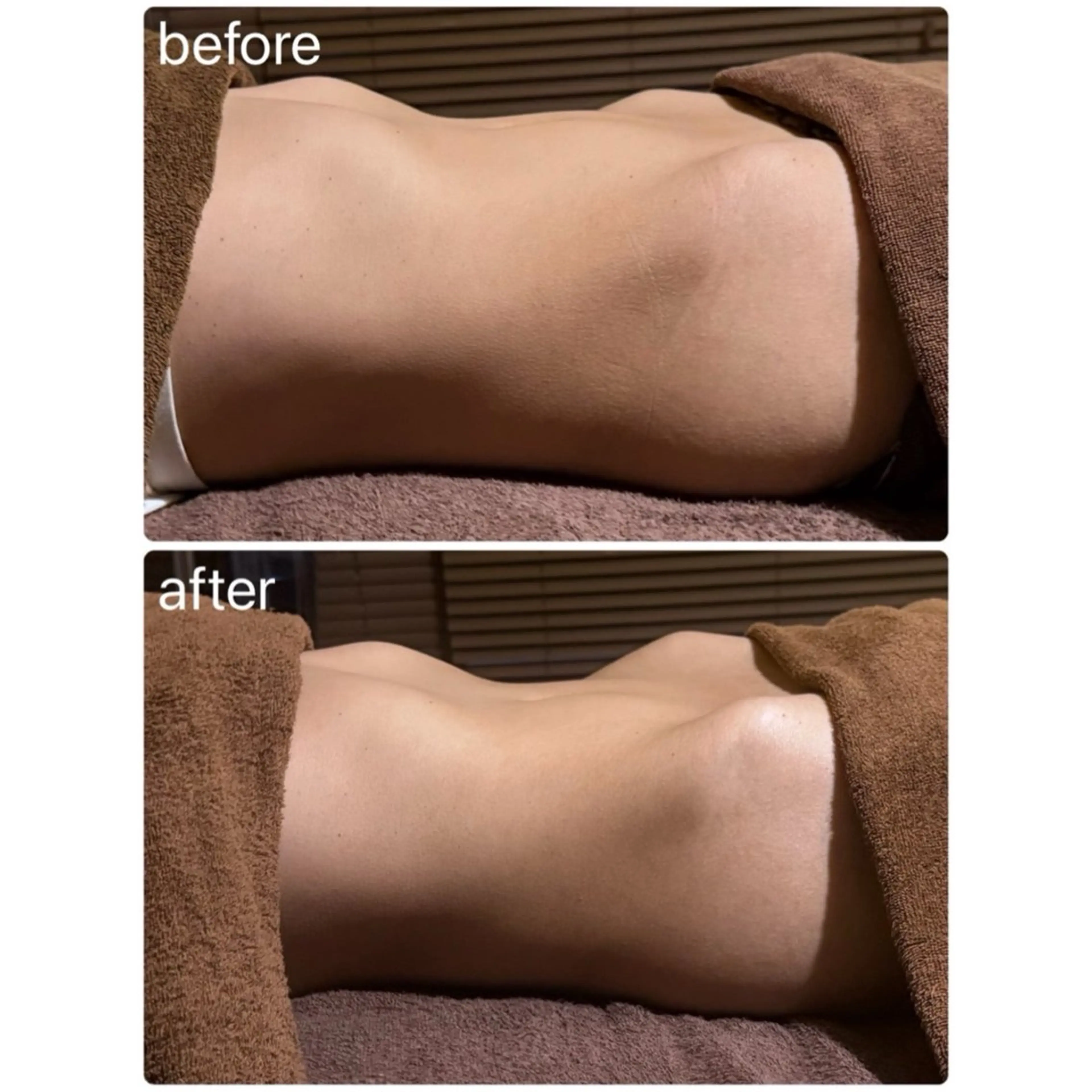 巡りスイッチON！溜め込みを脱ぎ捨てる、腸デトックスの写真