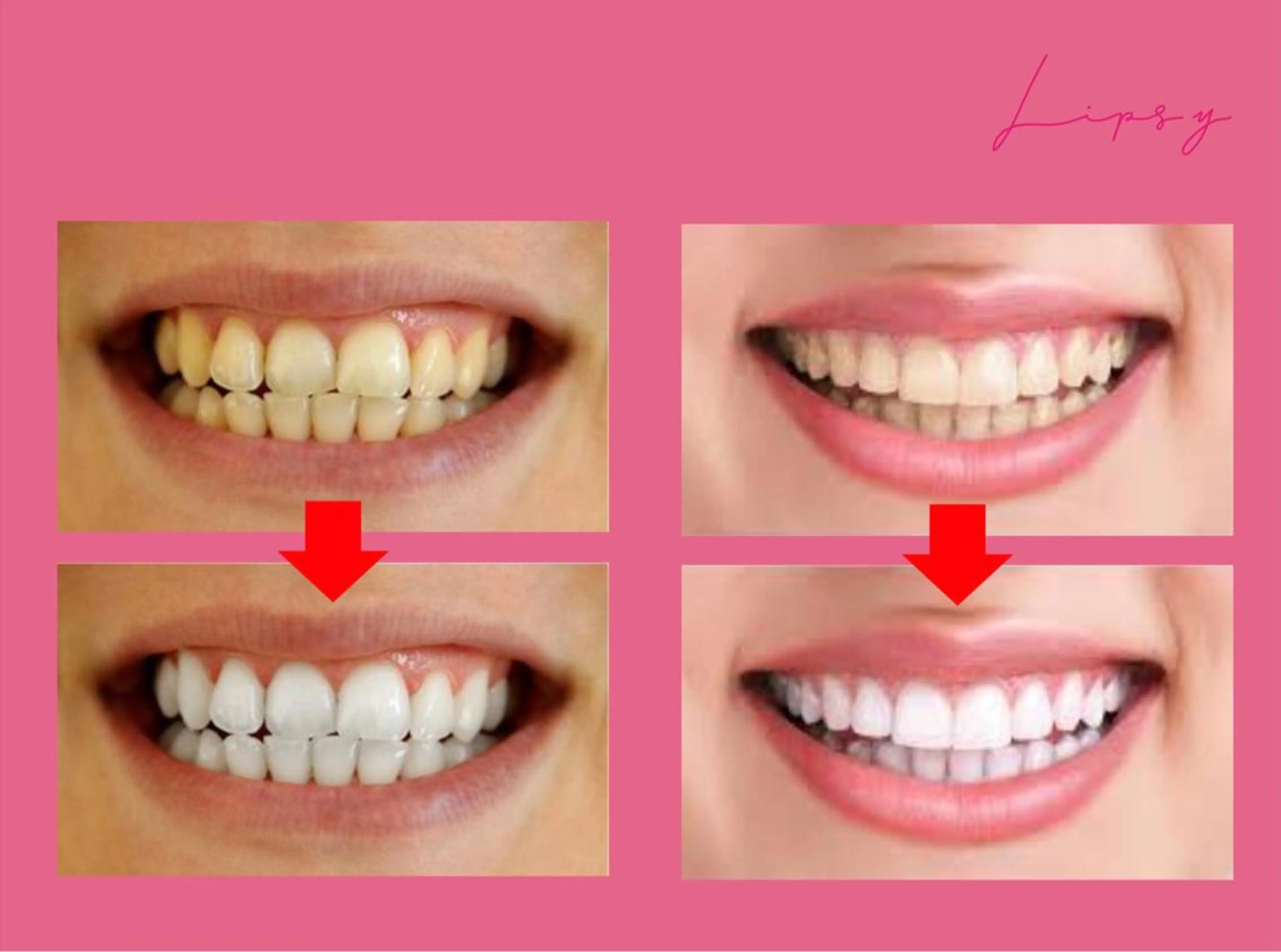 その他 Beautyサロン noel de miのエステ・リラクイメージ