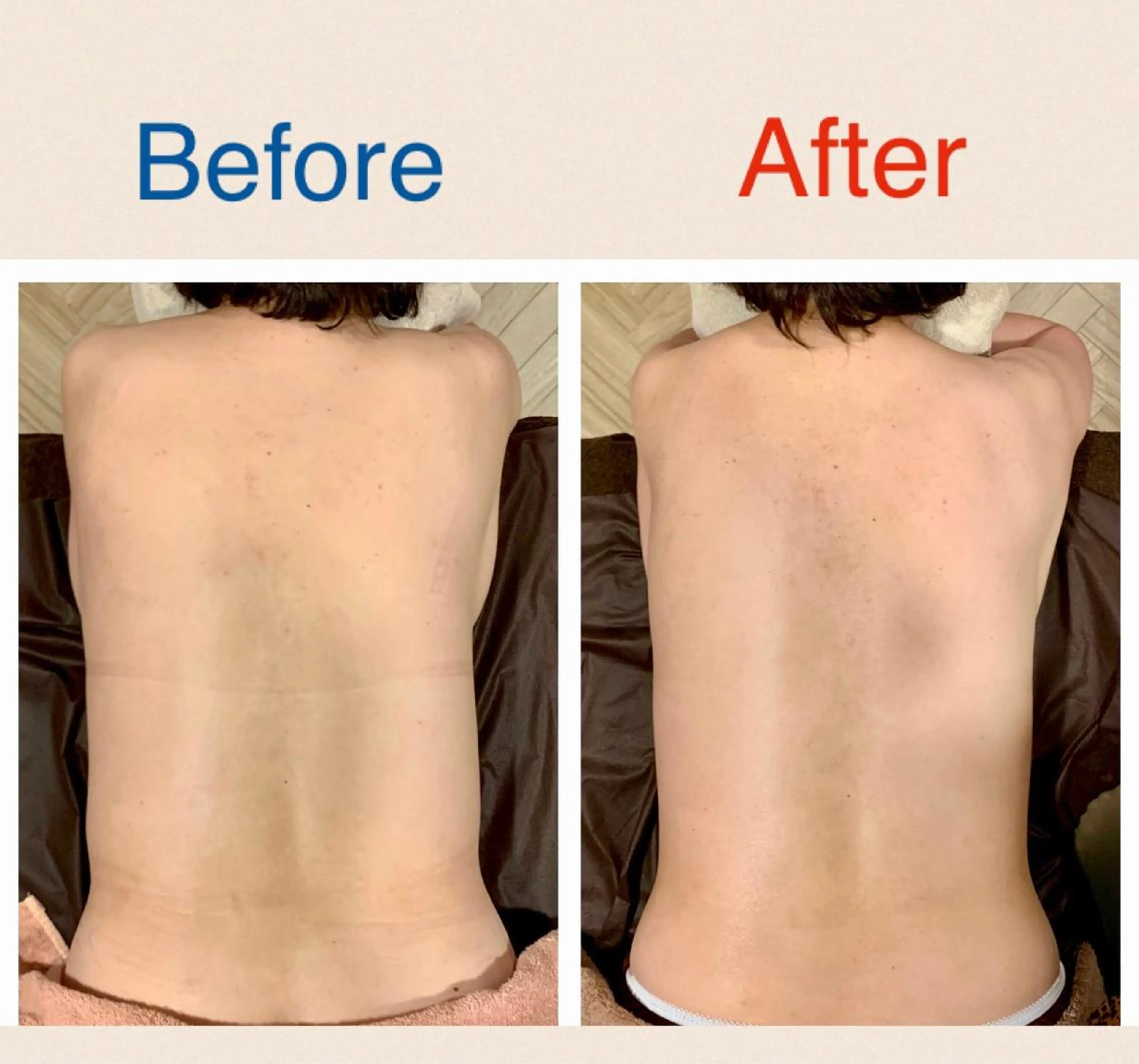 Rewhite -リホワイト-のエステ・リラクイメージ