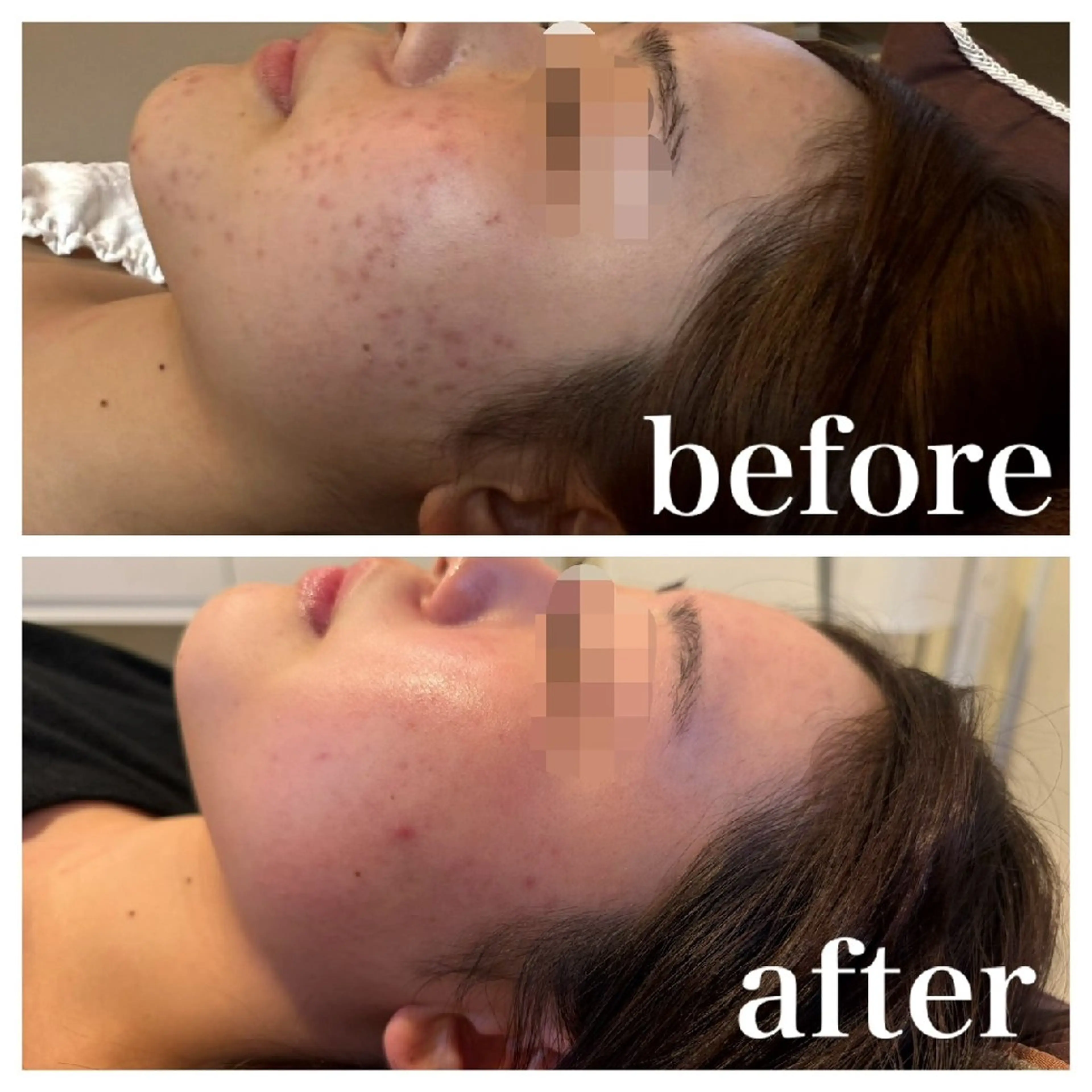 エステ リラク 肌質改善Beauty salon Renのエステ・リラクイメージ