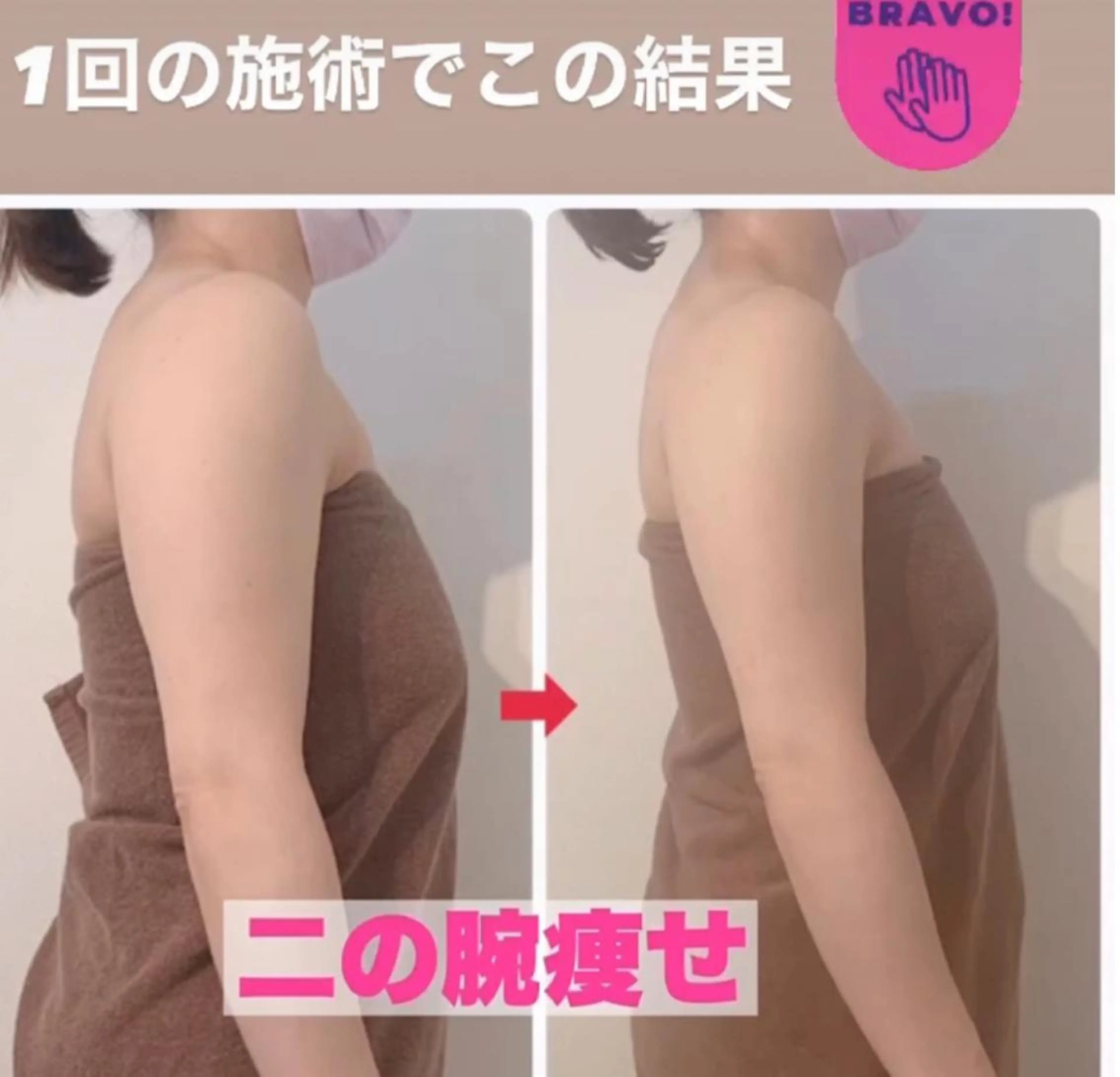 二の腕揉み出しの写真